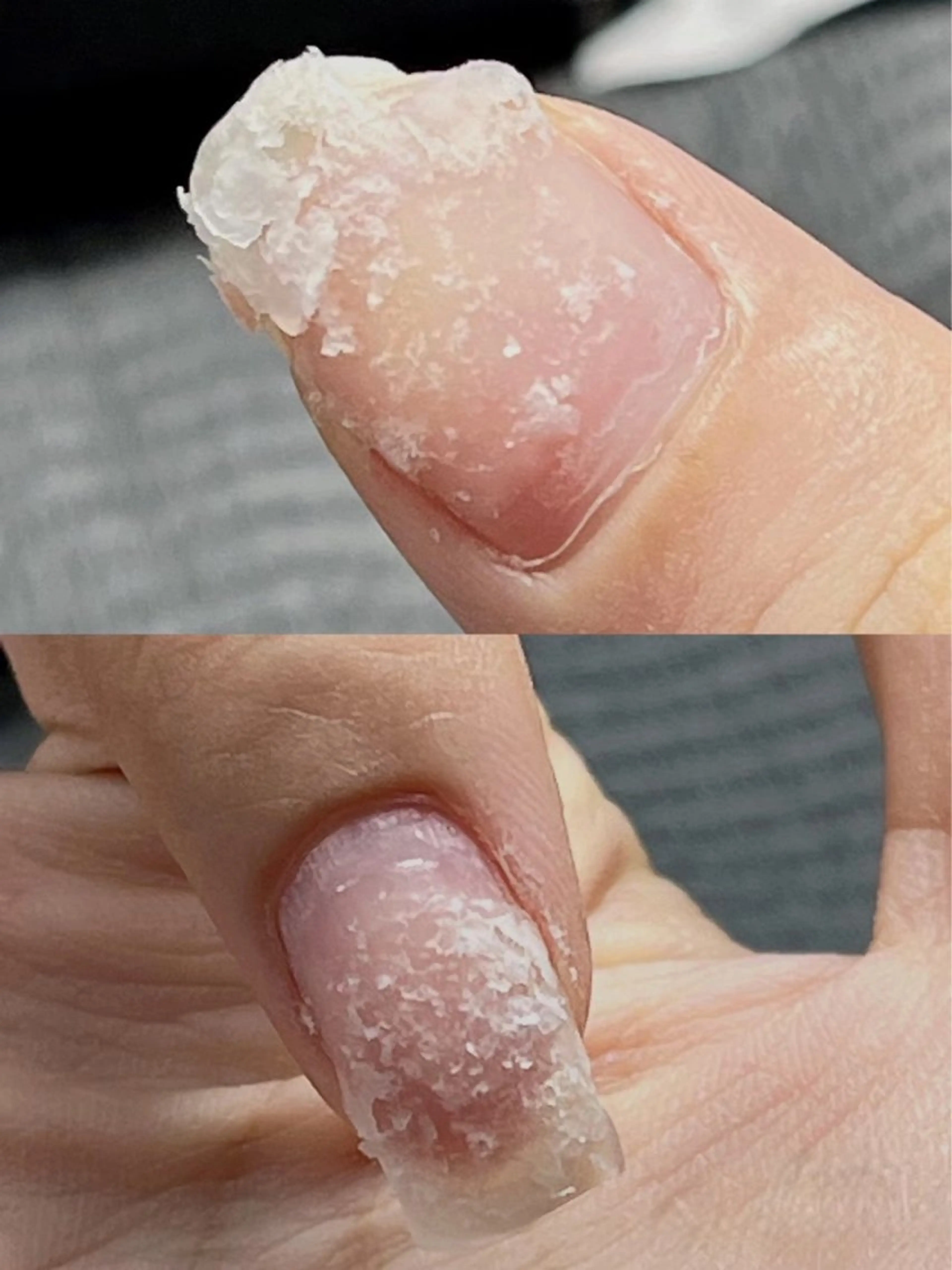 ハンドスカルプオフの写真