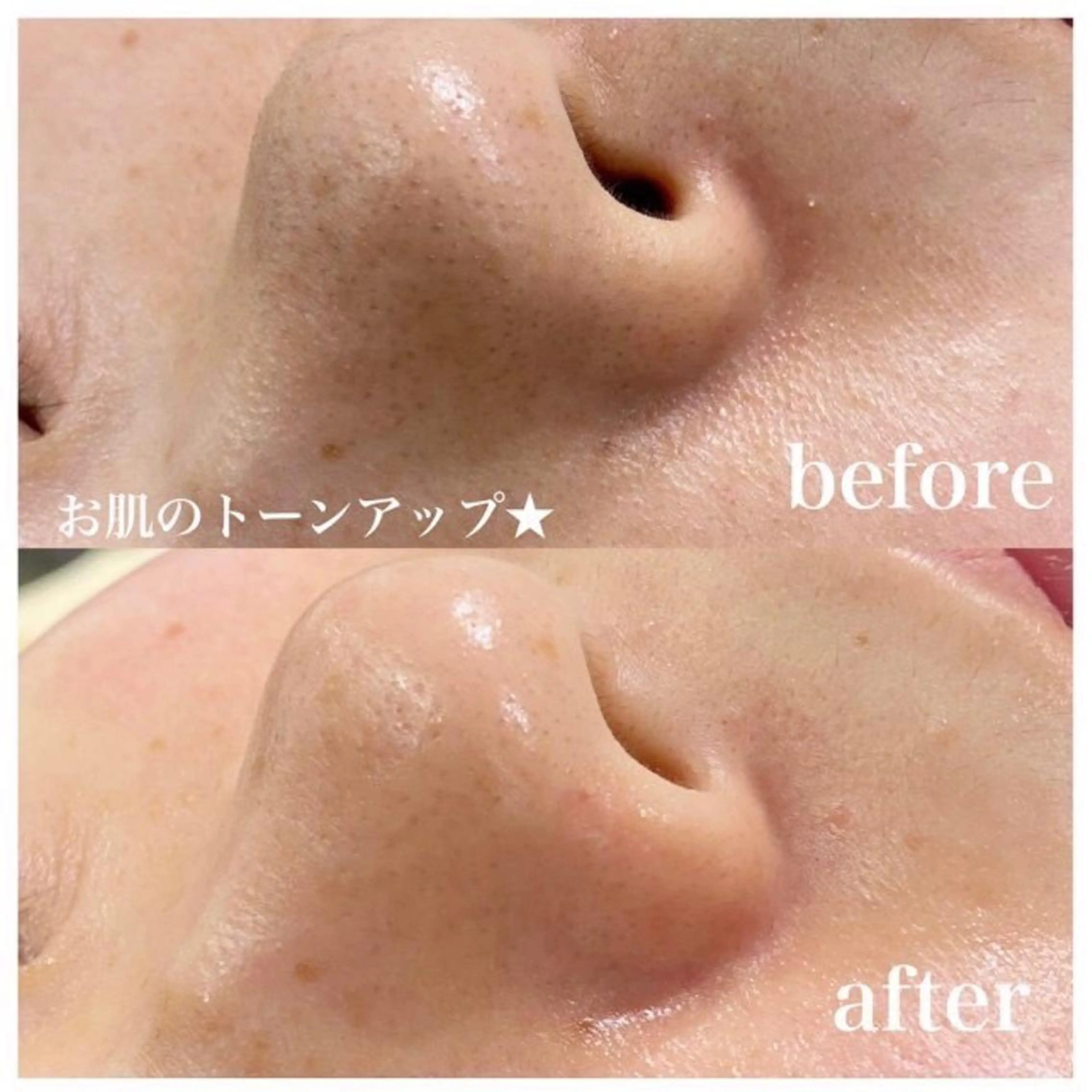 Belinda 中和の眉毛・アイブロウイメージ