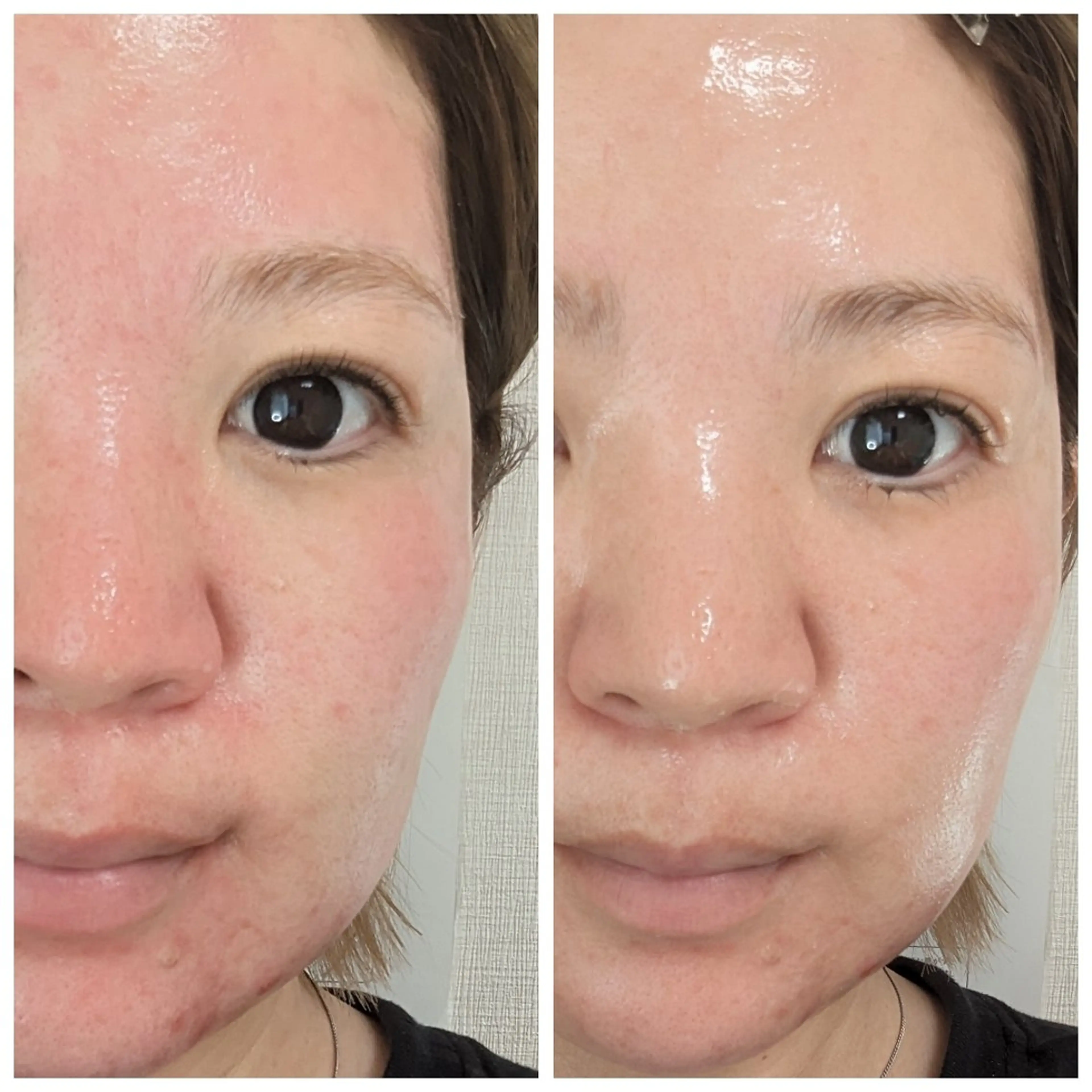 結果が出るスキンケア 肌質改善/まつパのエステ・リラクイメージ