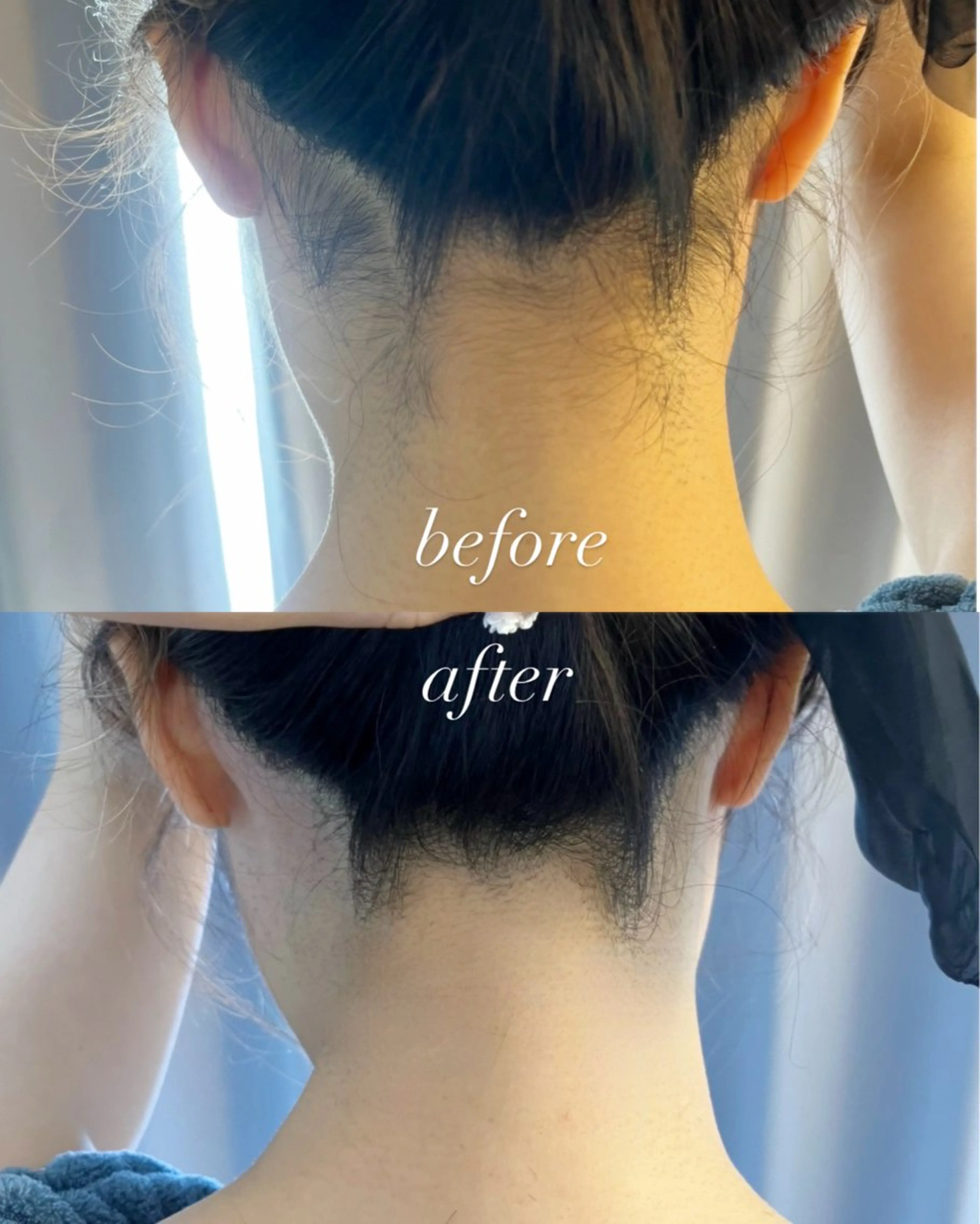 うなじ脱毛/美肌脱毛 LABELのエステ・リラクイメージ