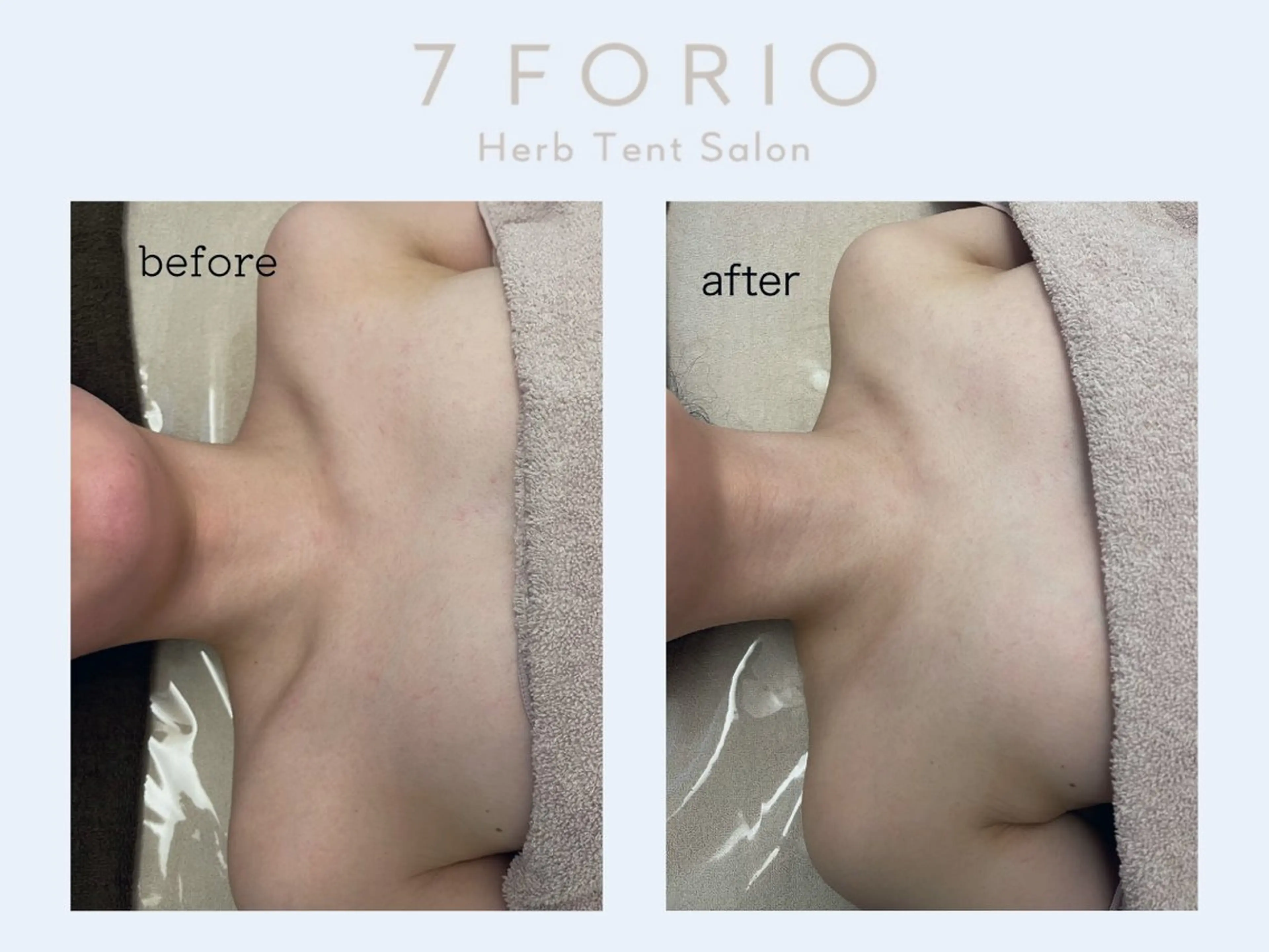 エステ リラク 7FORIO所属・低温個室ハーブサウナ NAHOのエステ・リラクイメージ