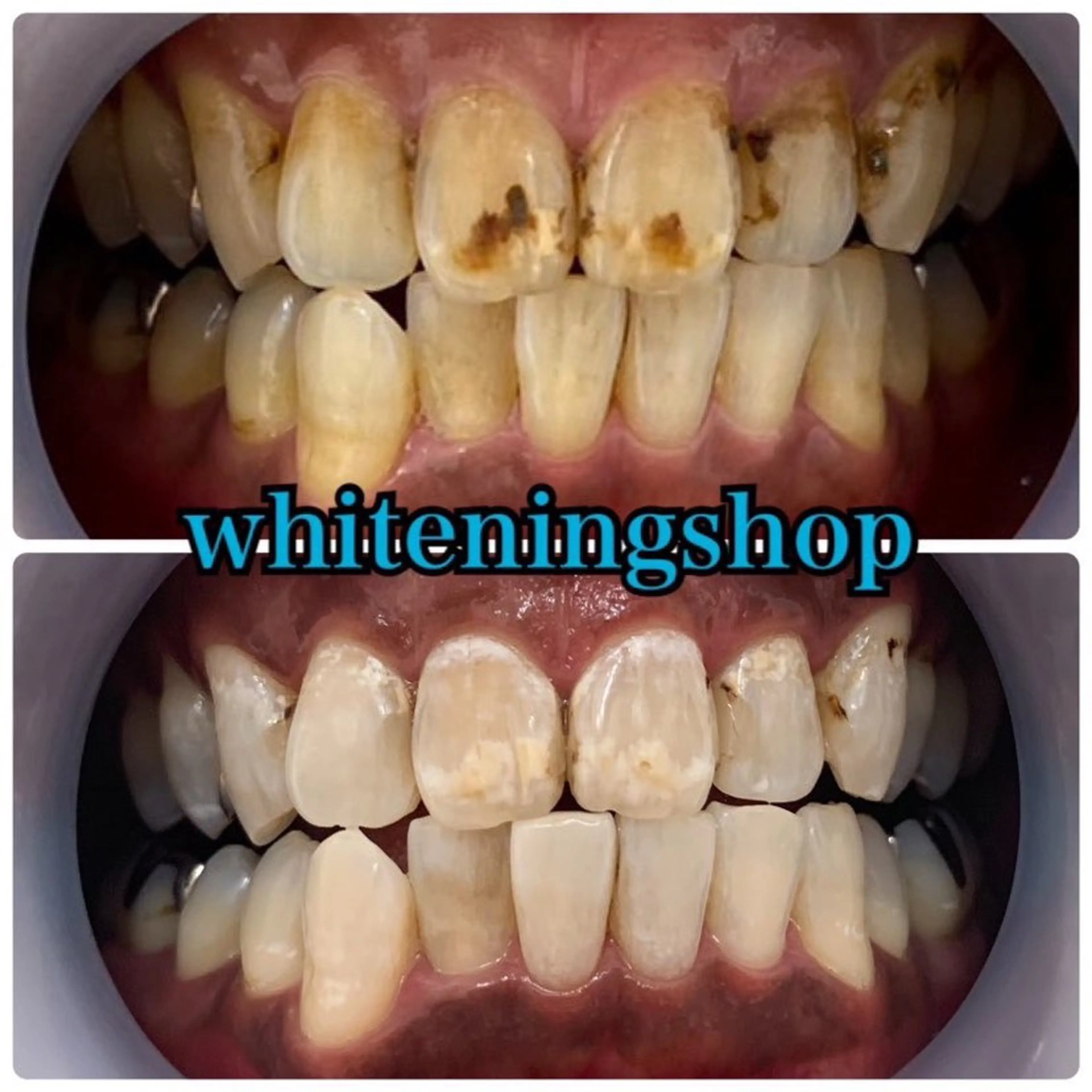 ホワイトニング ショップ津店のその他イメージ