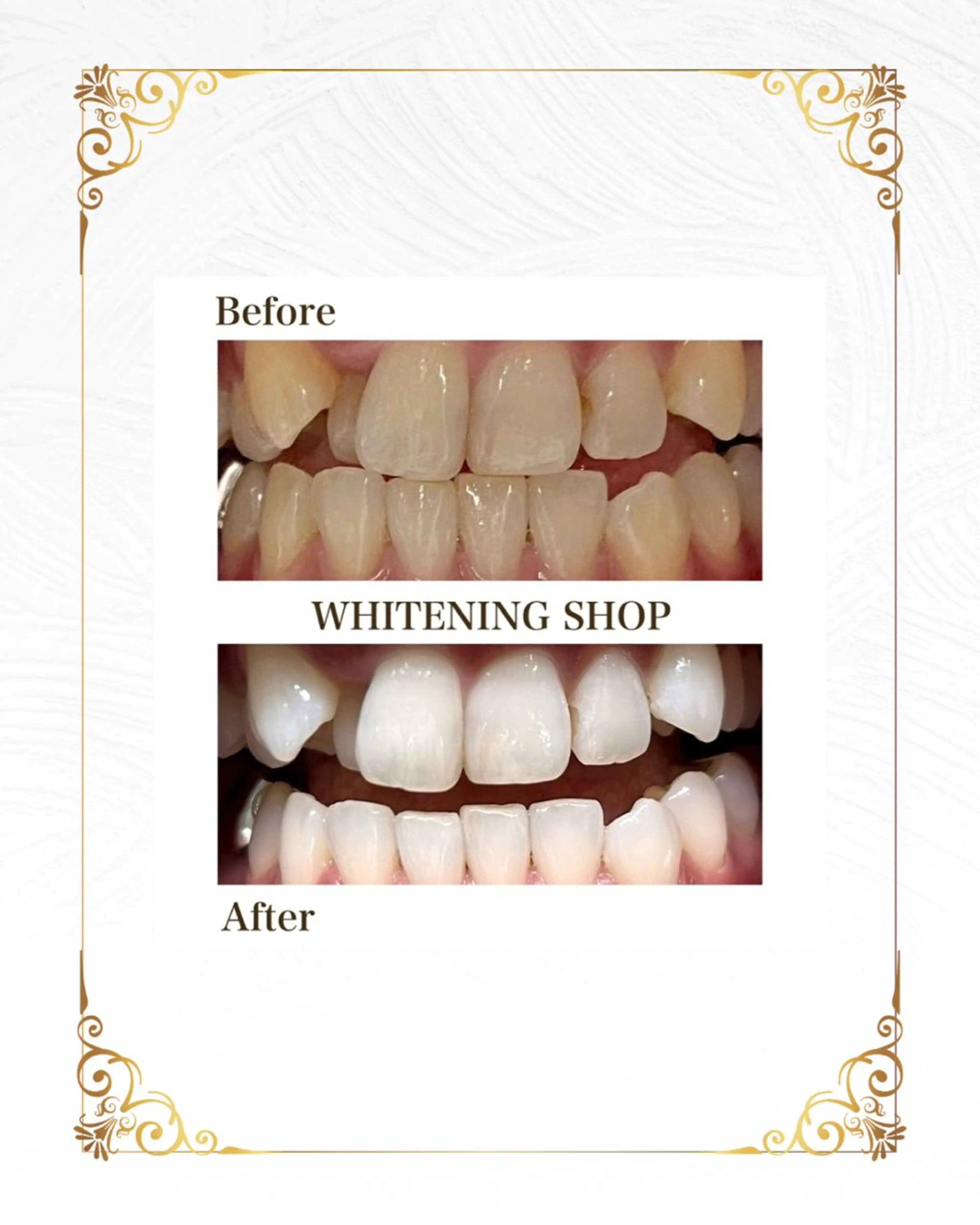 ホワイトニング ショップ葵区静岡駅店のその他イメージ