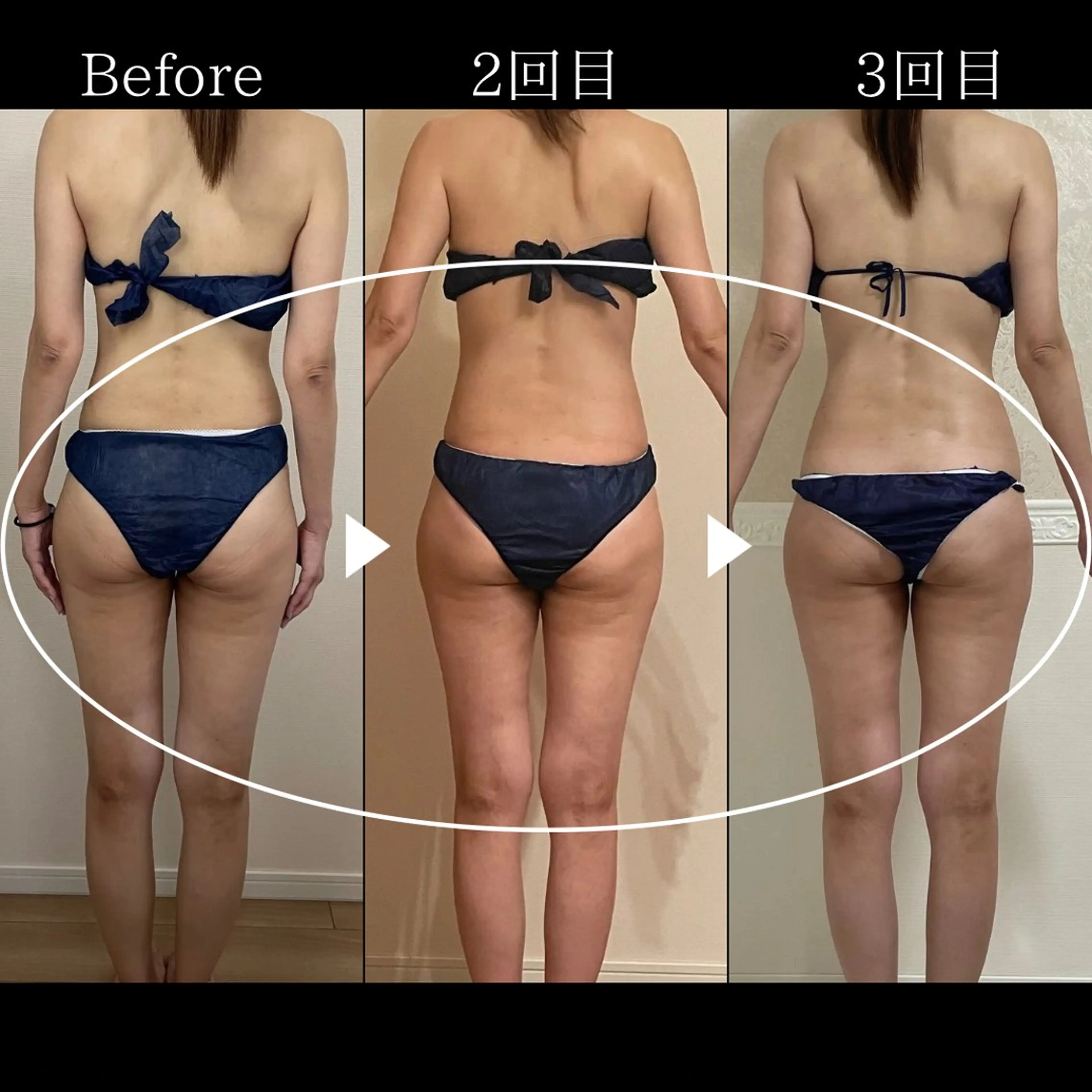 オフ:オン 全身筋膜マッサージのエステ・リラクイメージ