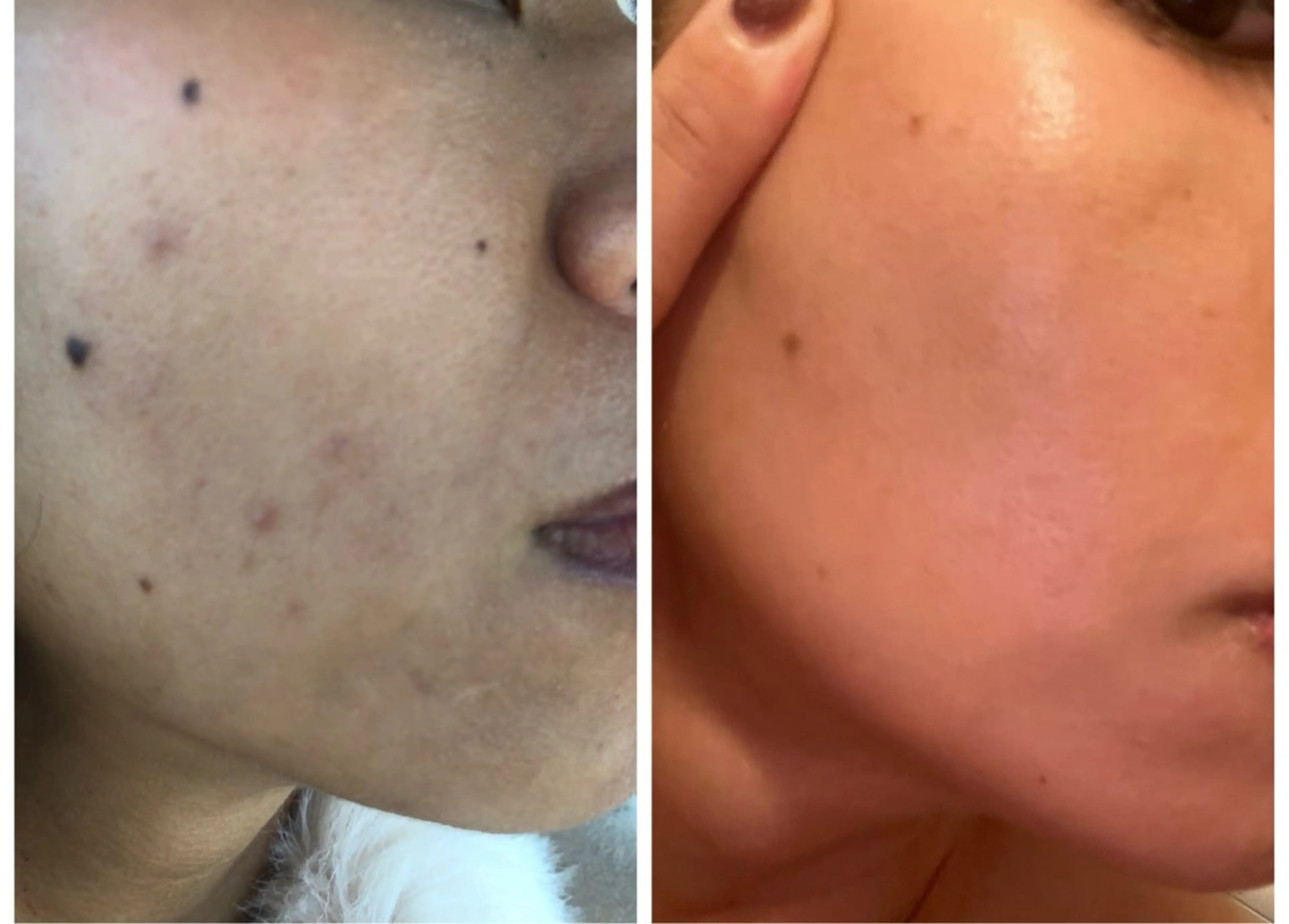 エステ sally emiry 柏店所属・sallyemiry 小顔コルギのエステ・リラクイメージ