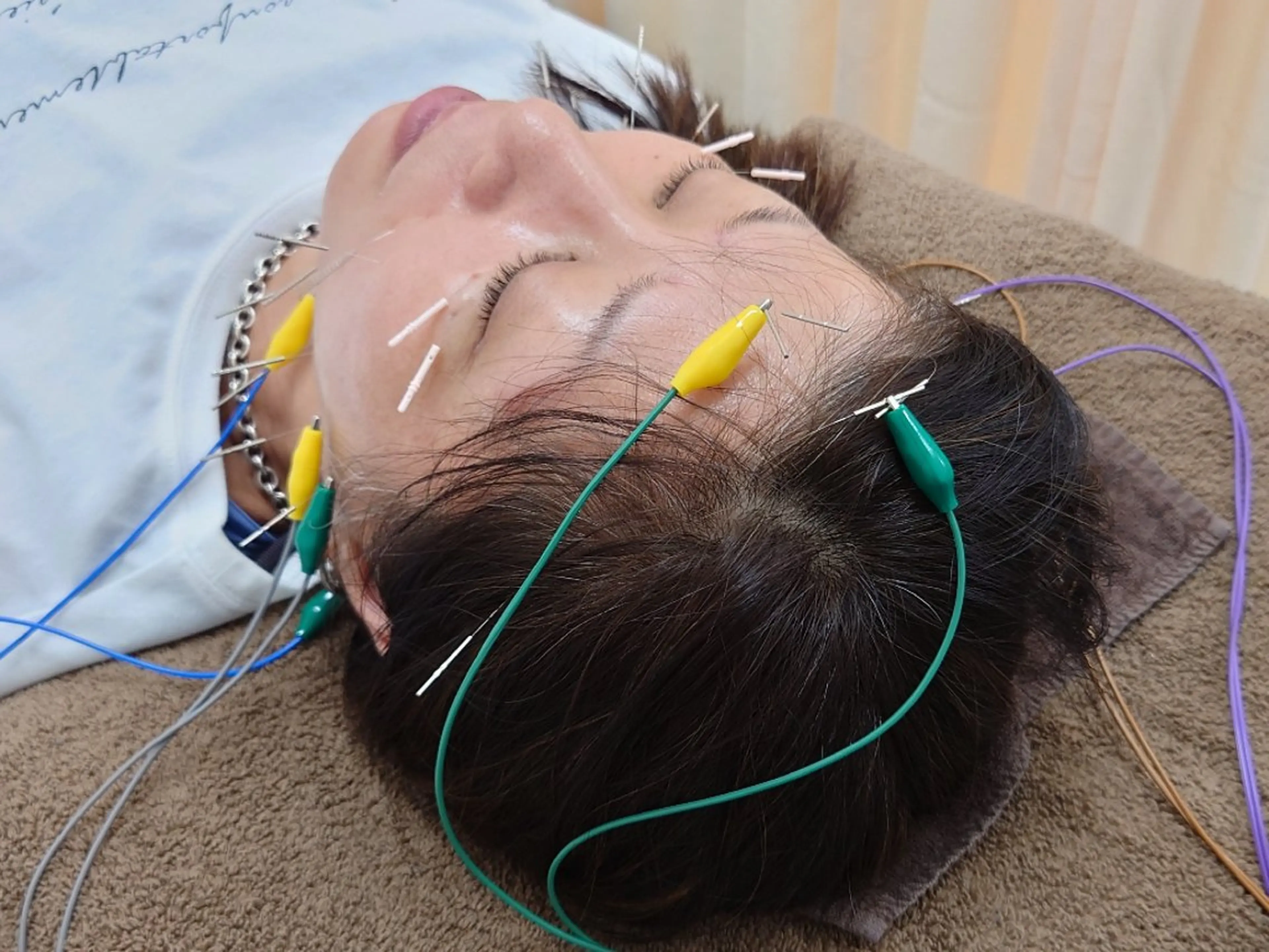 スカイブルー 鍼灸接骨院　佐々木のエステ・リラクイメージ