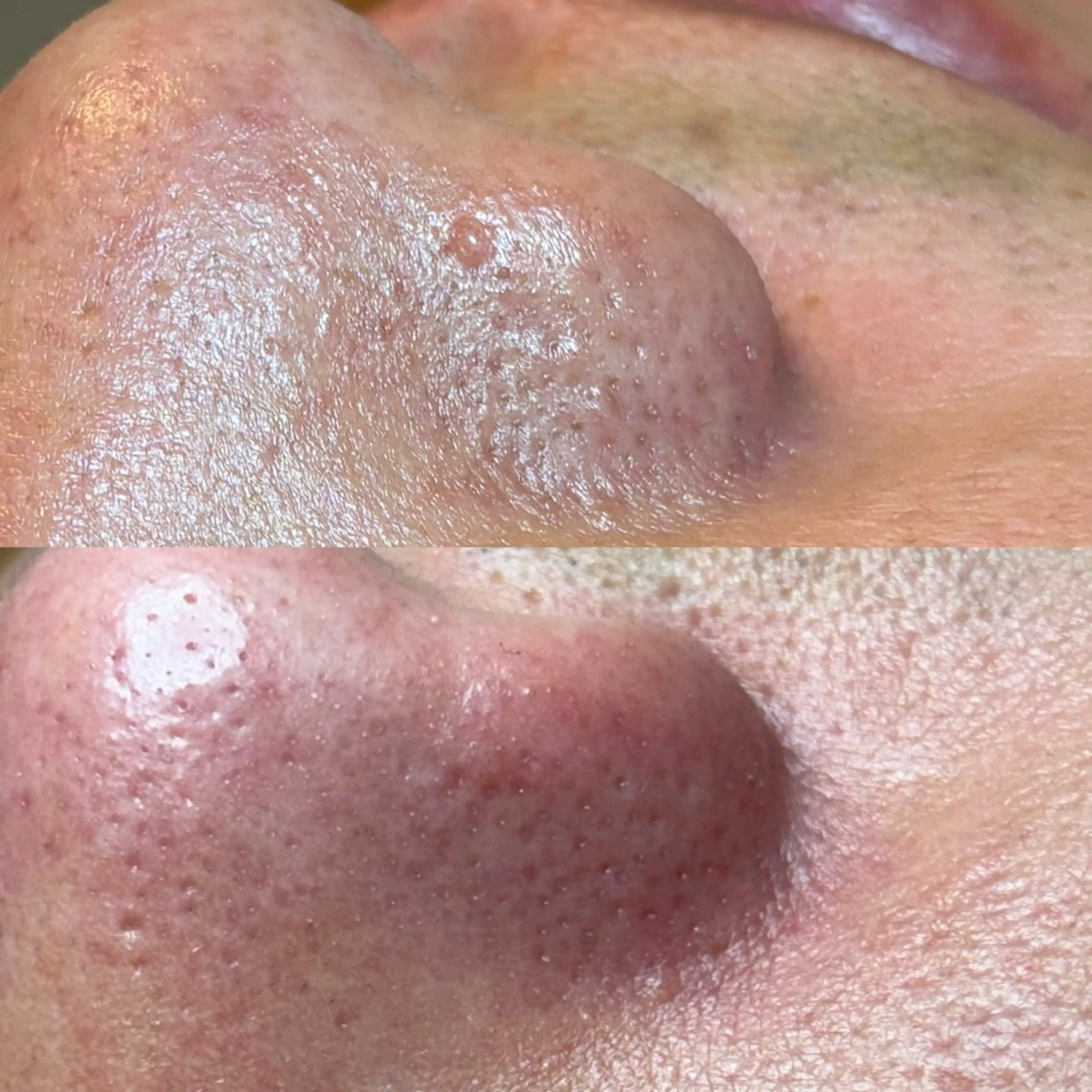 その他 セルフエステエンリケ明石大久保店所属・夕希 毛穴と脱毛特化サロンのエステ・リラクイメージ