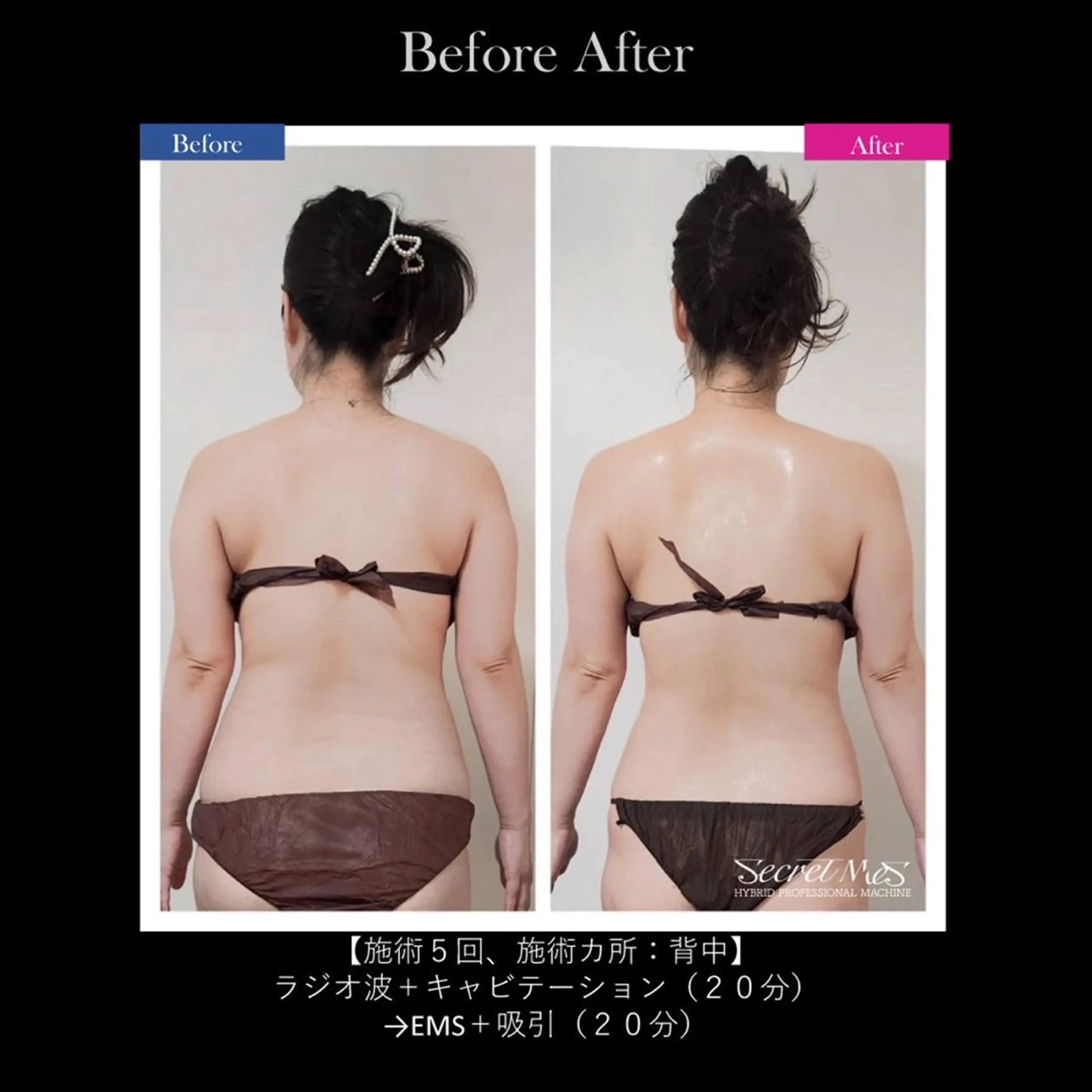 小顔美肌痩身サロン Ranのその他イメージ