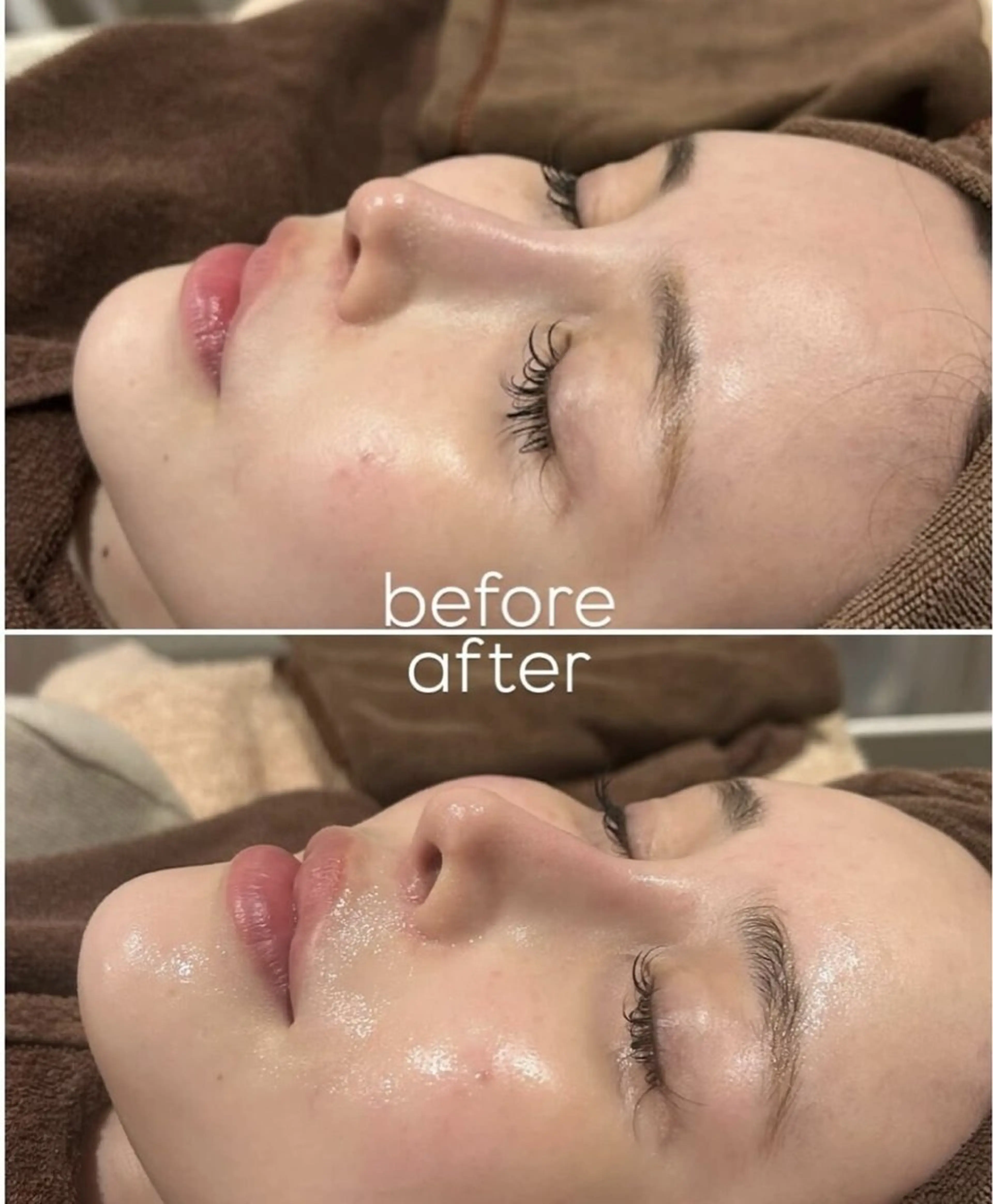 エステ Amour deuxのエステ・リラクイメージ