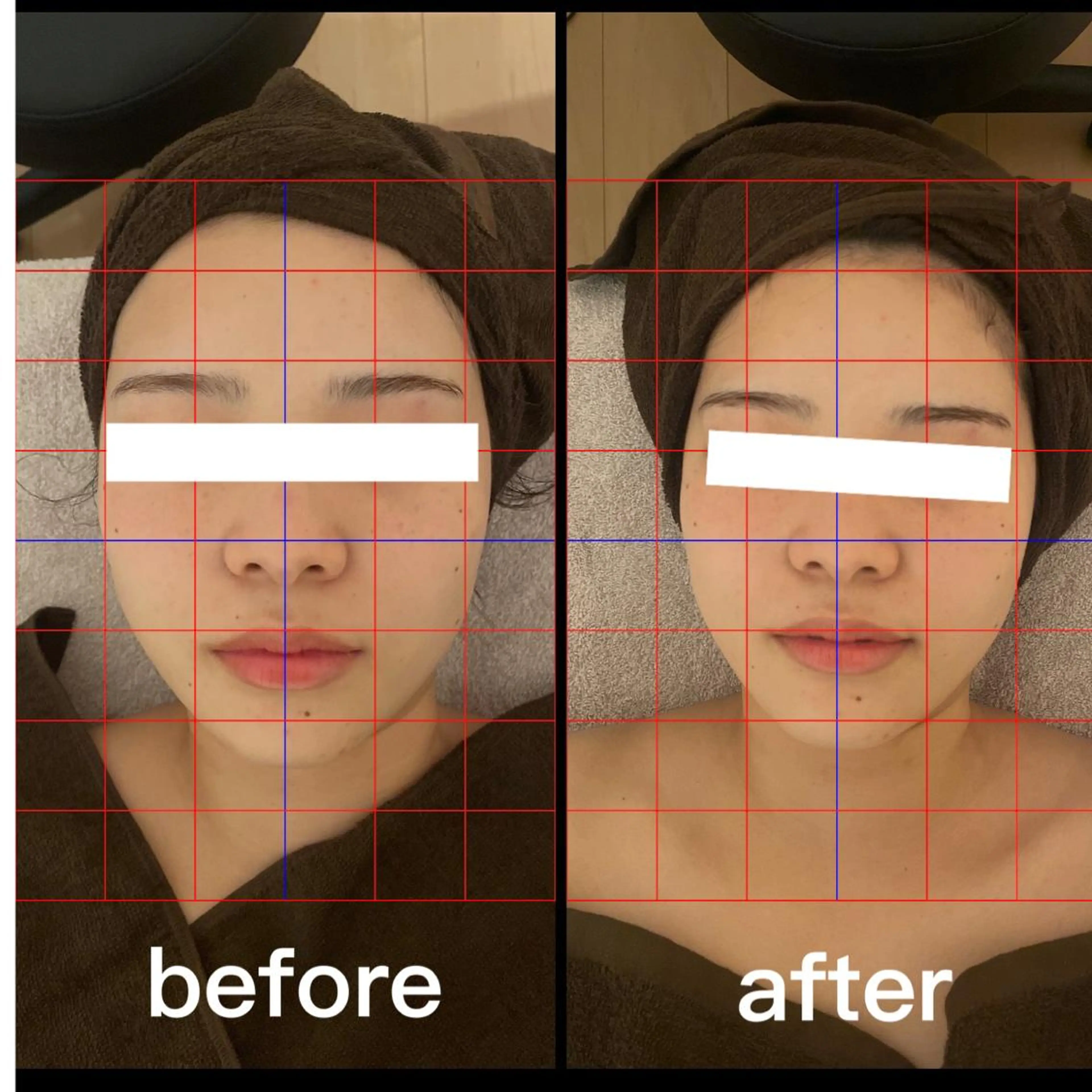 エステ フェイシャル専門店 regaloのエステ・リラクイメージ