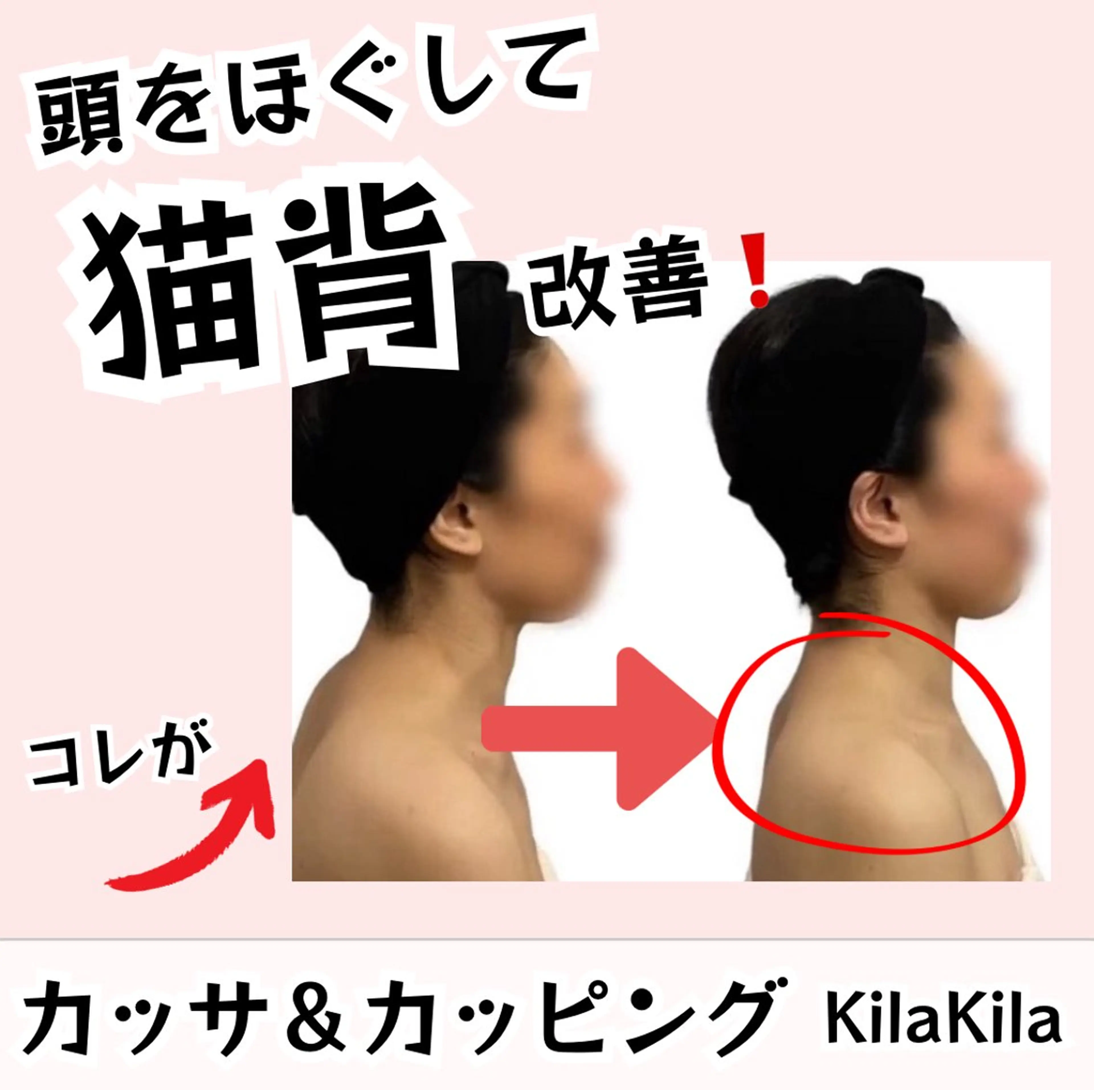 ドライヘッドスパ KilaKilaのエステ・リラクイメージ