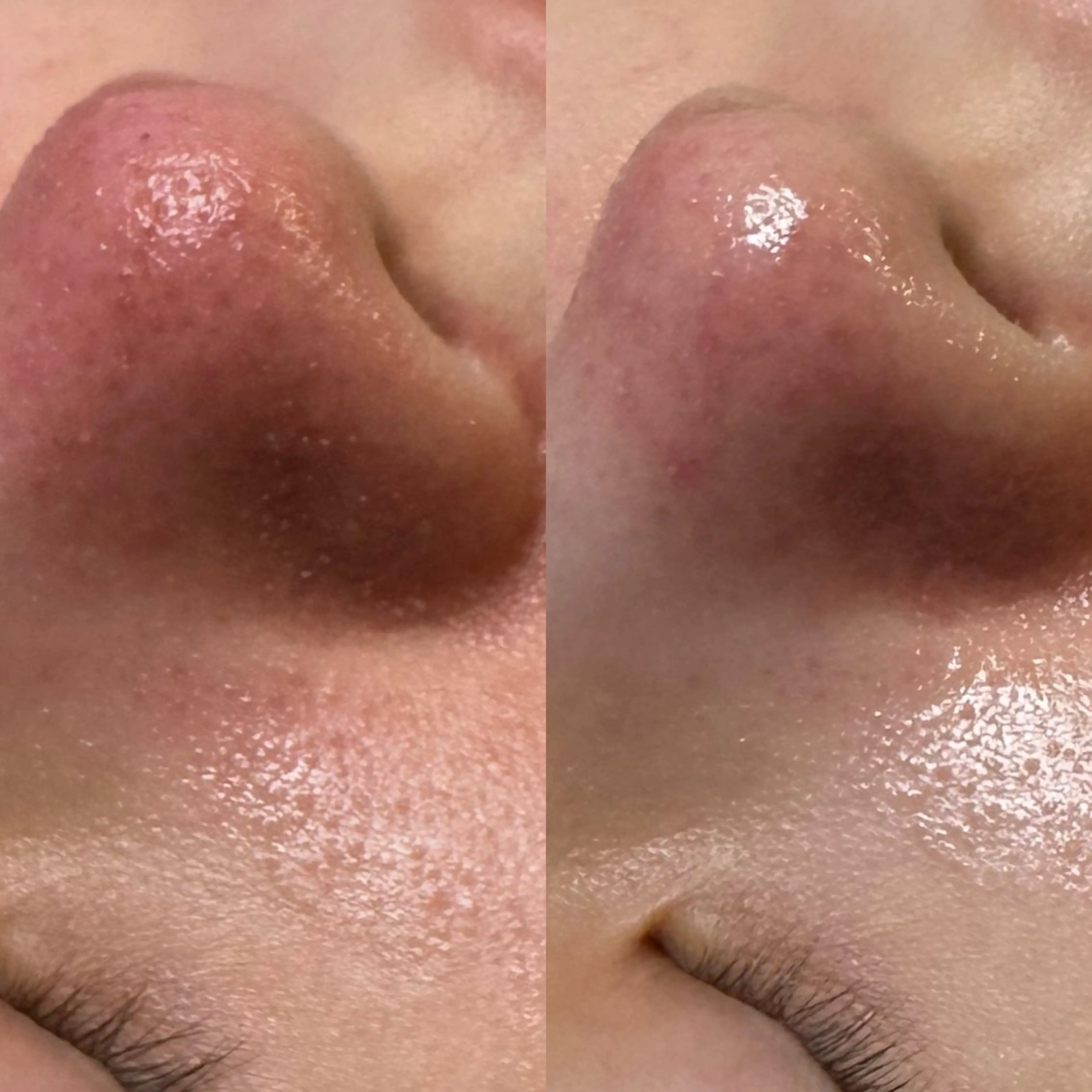 エステ 六本木脱毛andS 店長Sachiのエステ・リラクイメージ