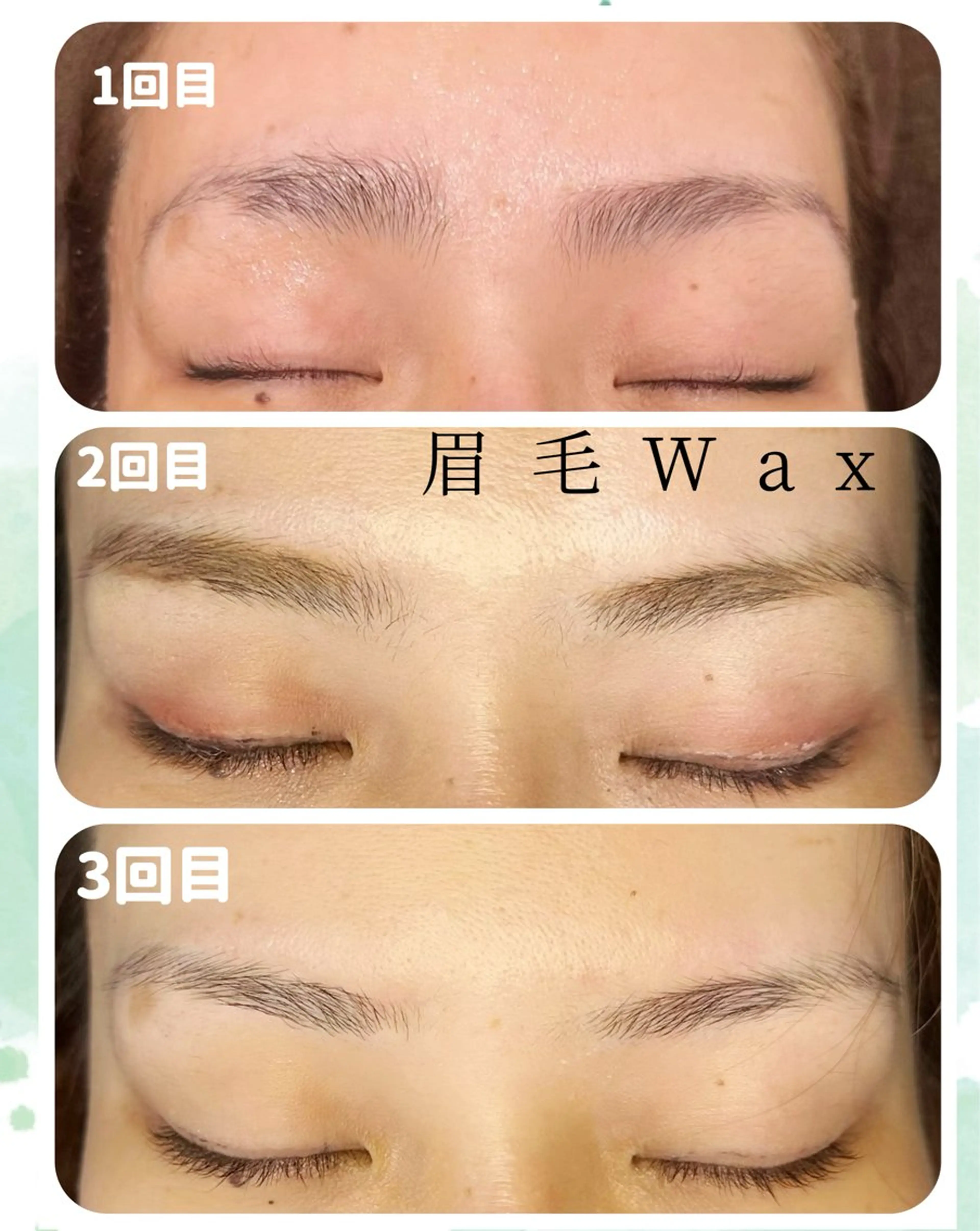 美眉アイブロウデザインWax ×フェイスWax（耳上額周り）の写真