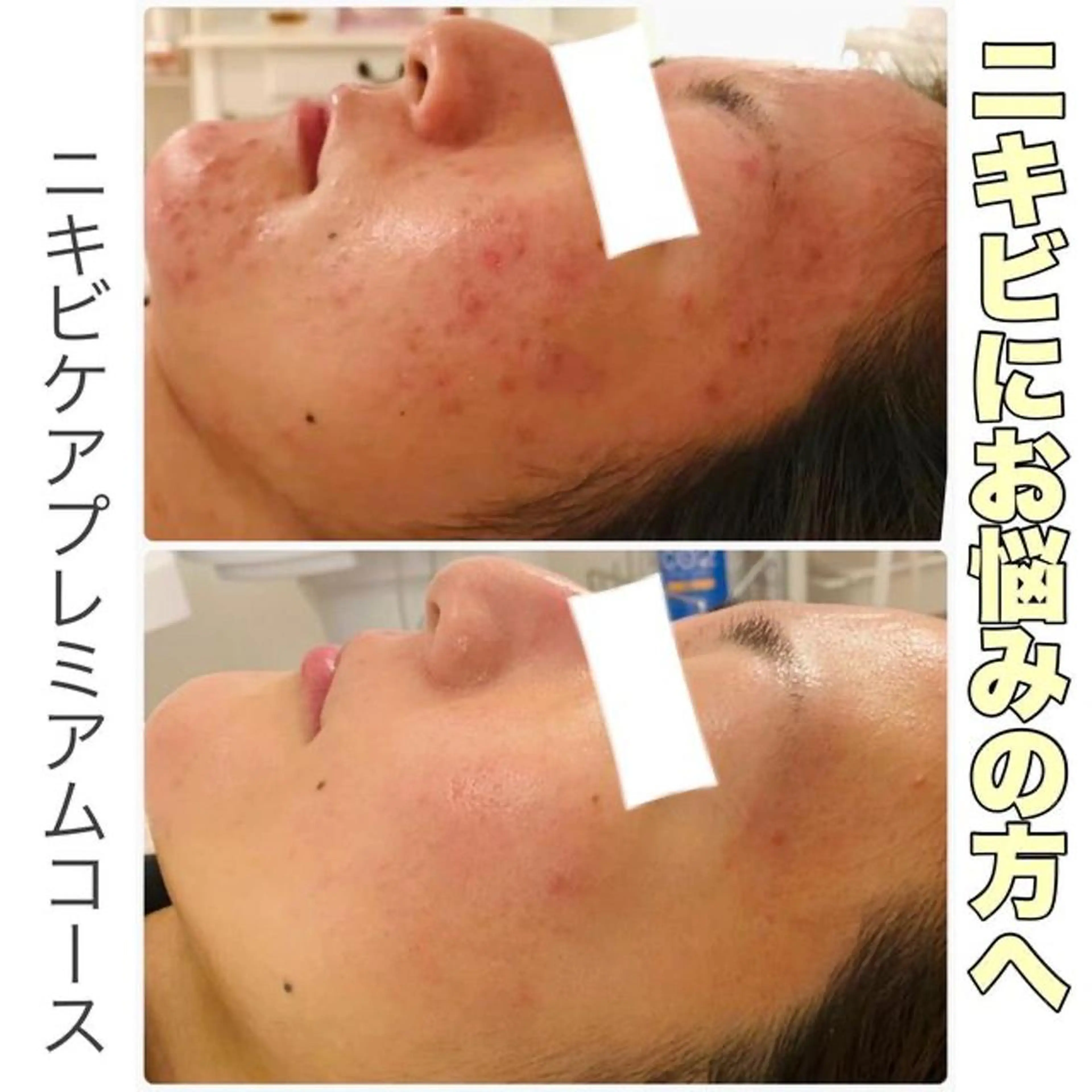 エステ フェイシャル専門 肌質改善/プランスのエステ・リラクイメージ