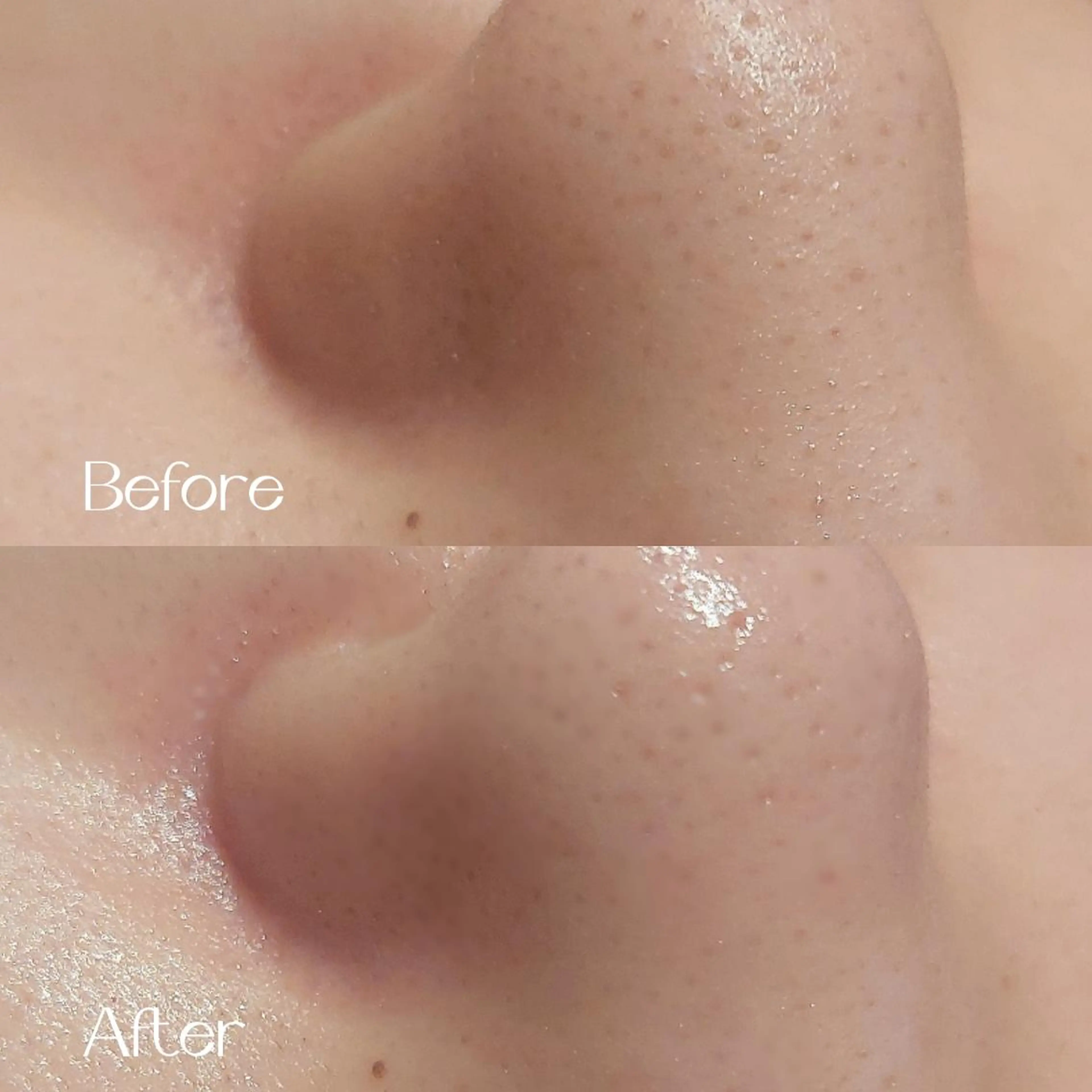 エステ MyFairLady miuのエステ・リラクイメージ