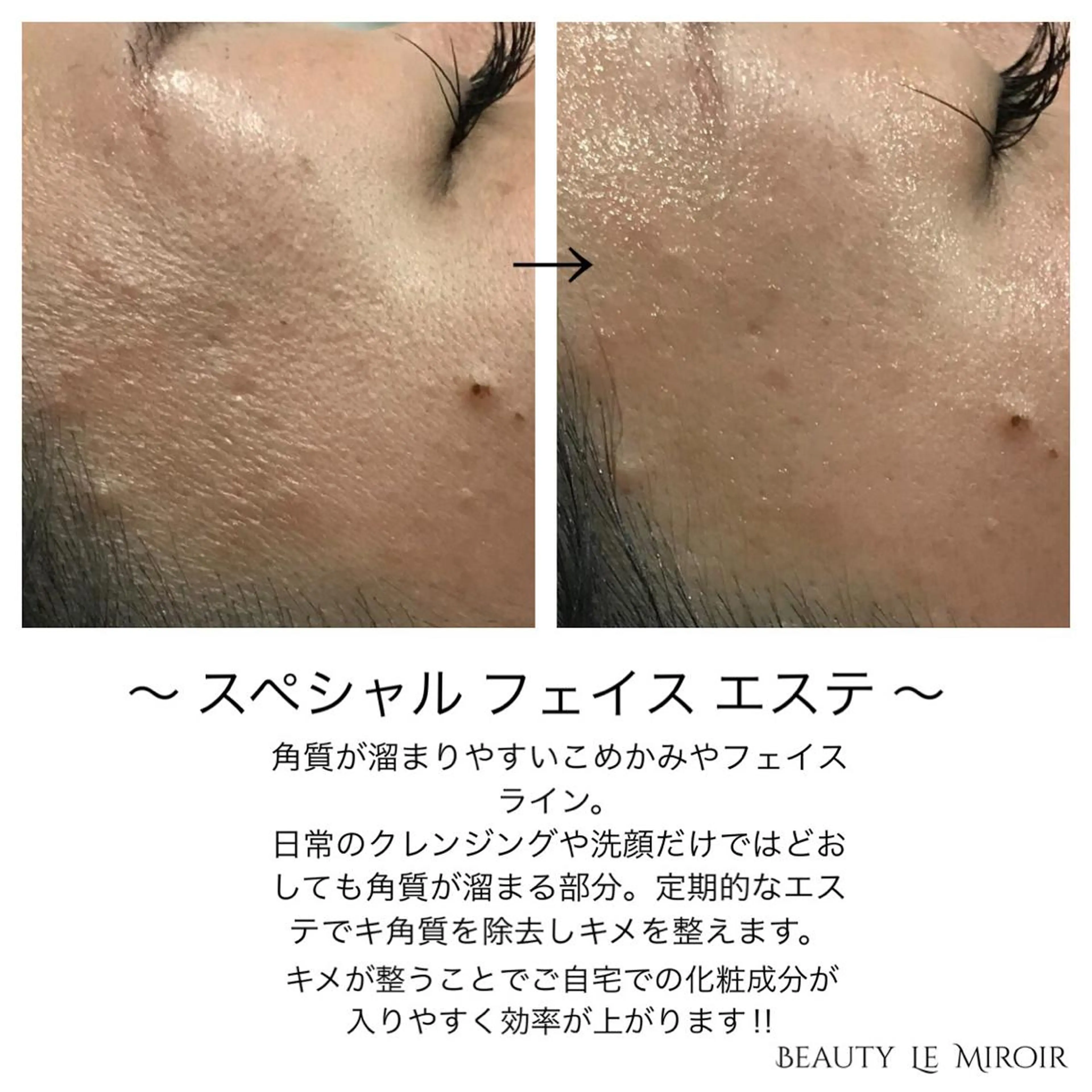 マツエク・マツパ ビューティー ミロワールのエステ・リラクイメージ