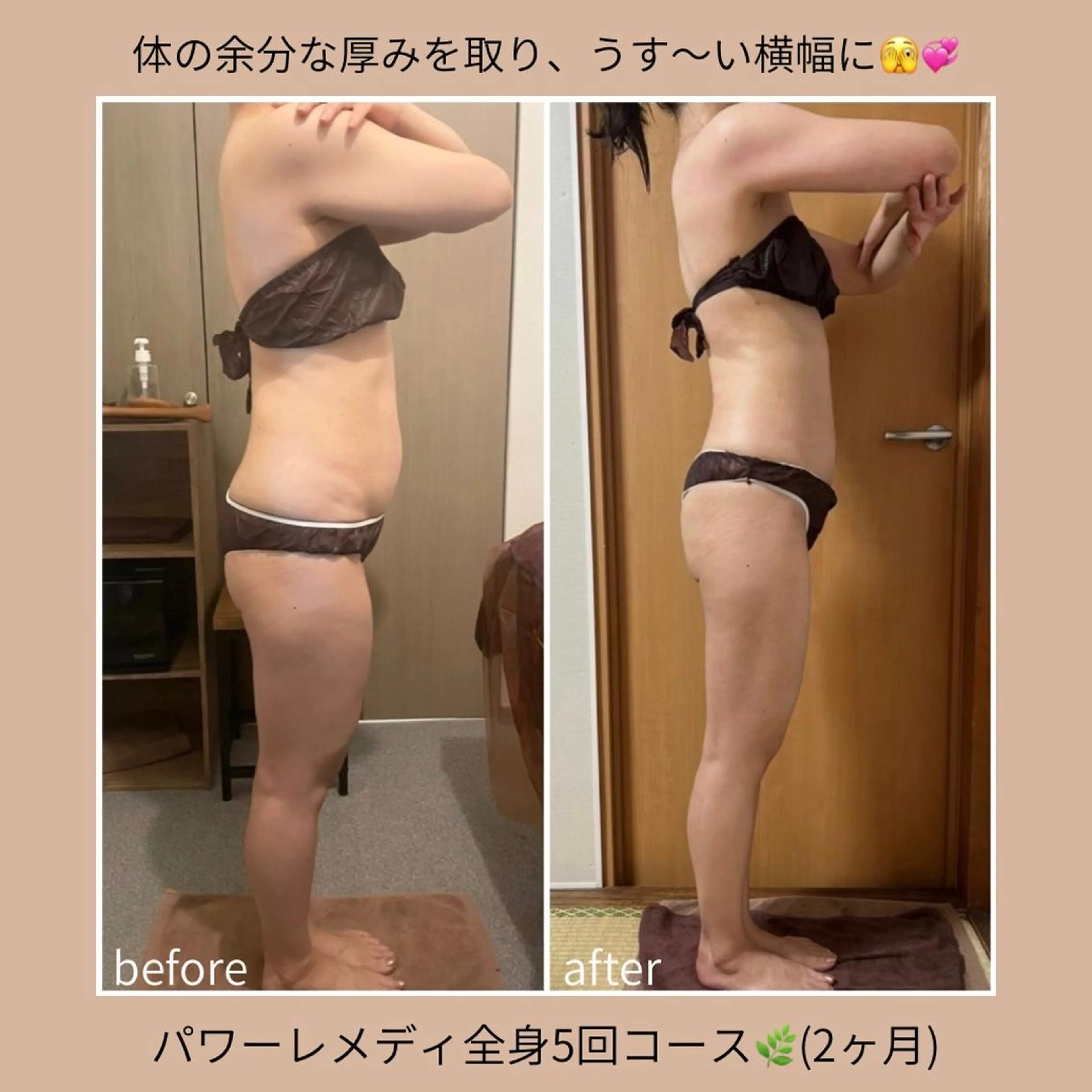 《本気痩せ×疲労改善 》  BILOOPのエステ・リラクイメージ