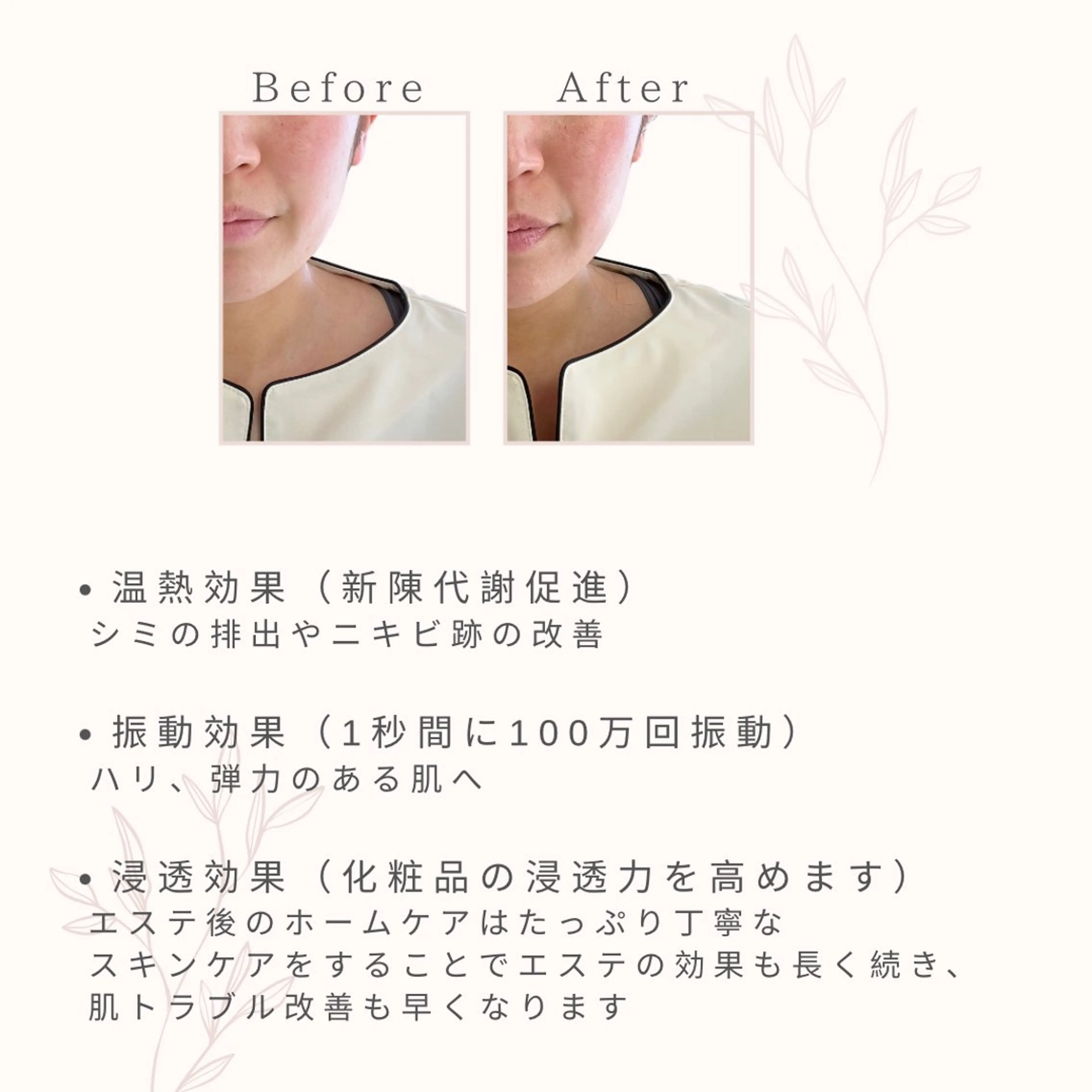 【美大生限定】超音波小顔エステの写真