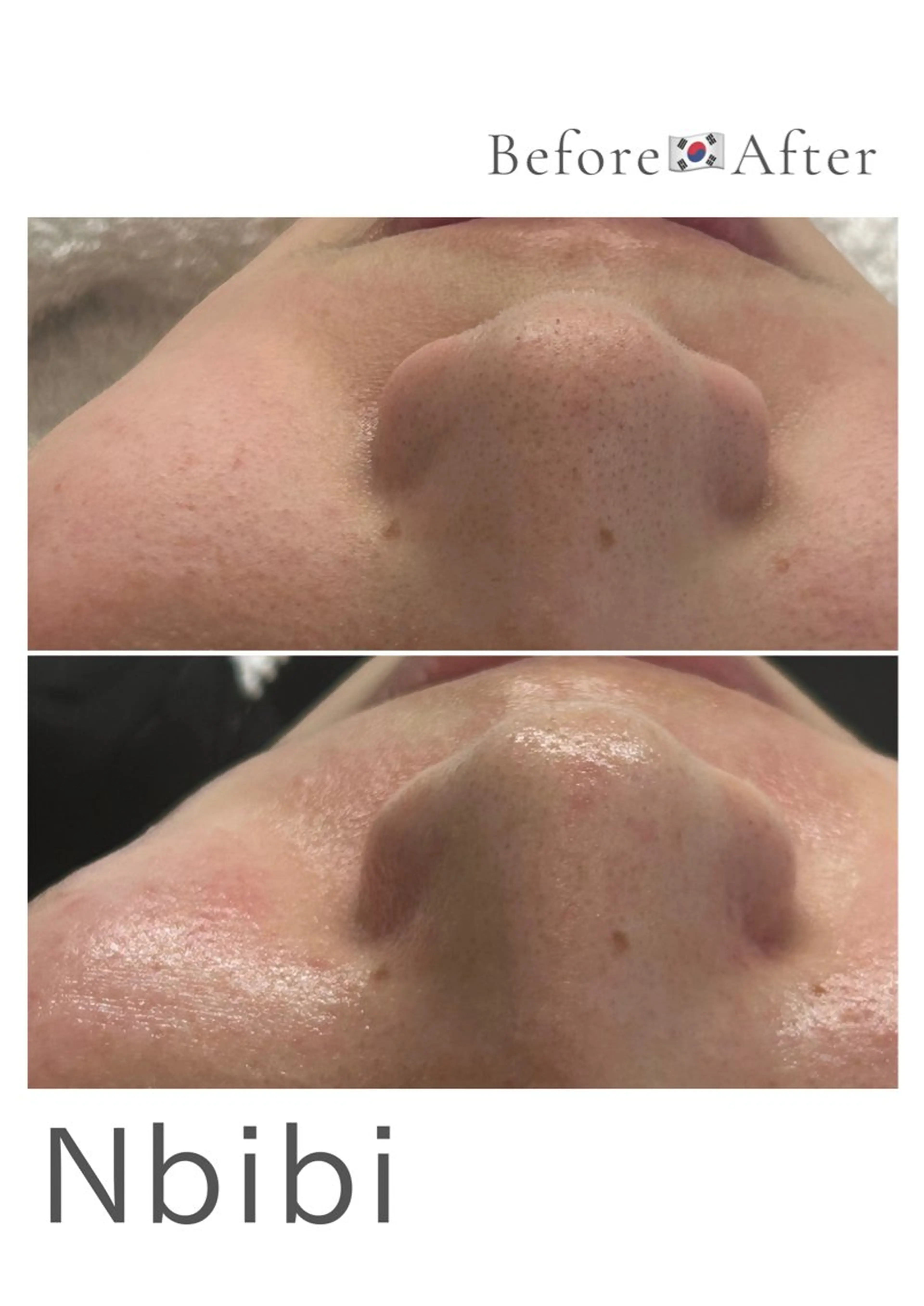 エステ 韓国🇰🇷価格 サロン_Nbibiの眉毛・アイブロウイメージ