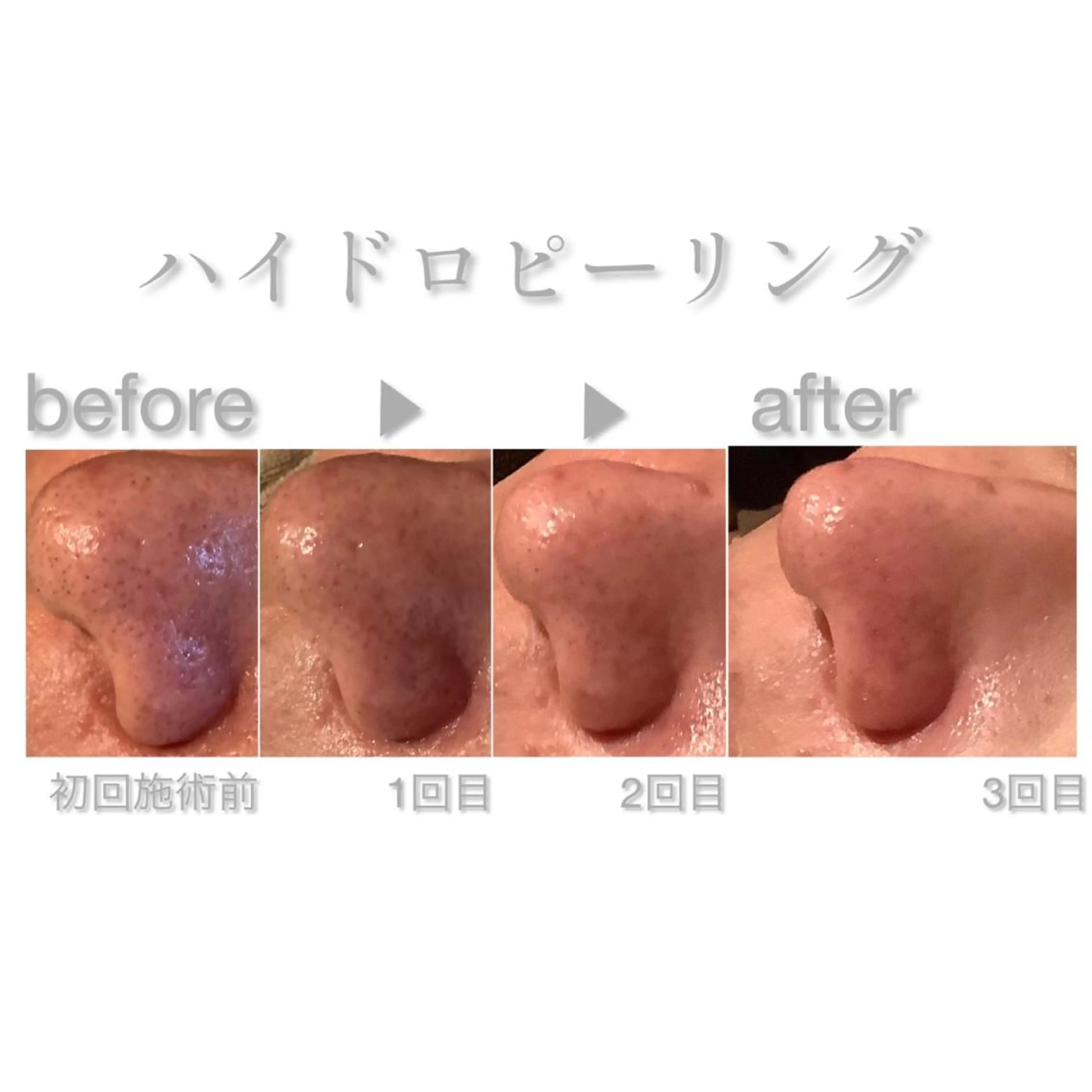 エステ 脱毛&エステサロン JIGGLY武蔵小山のエステ・リラクイメージ