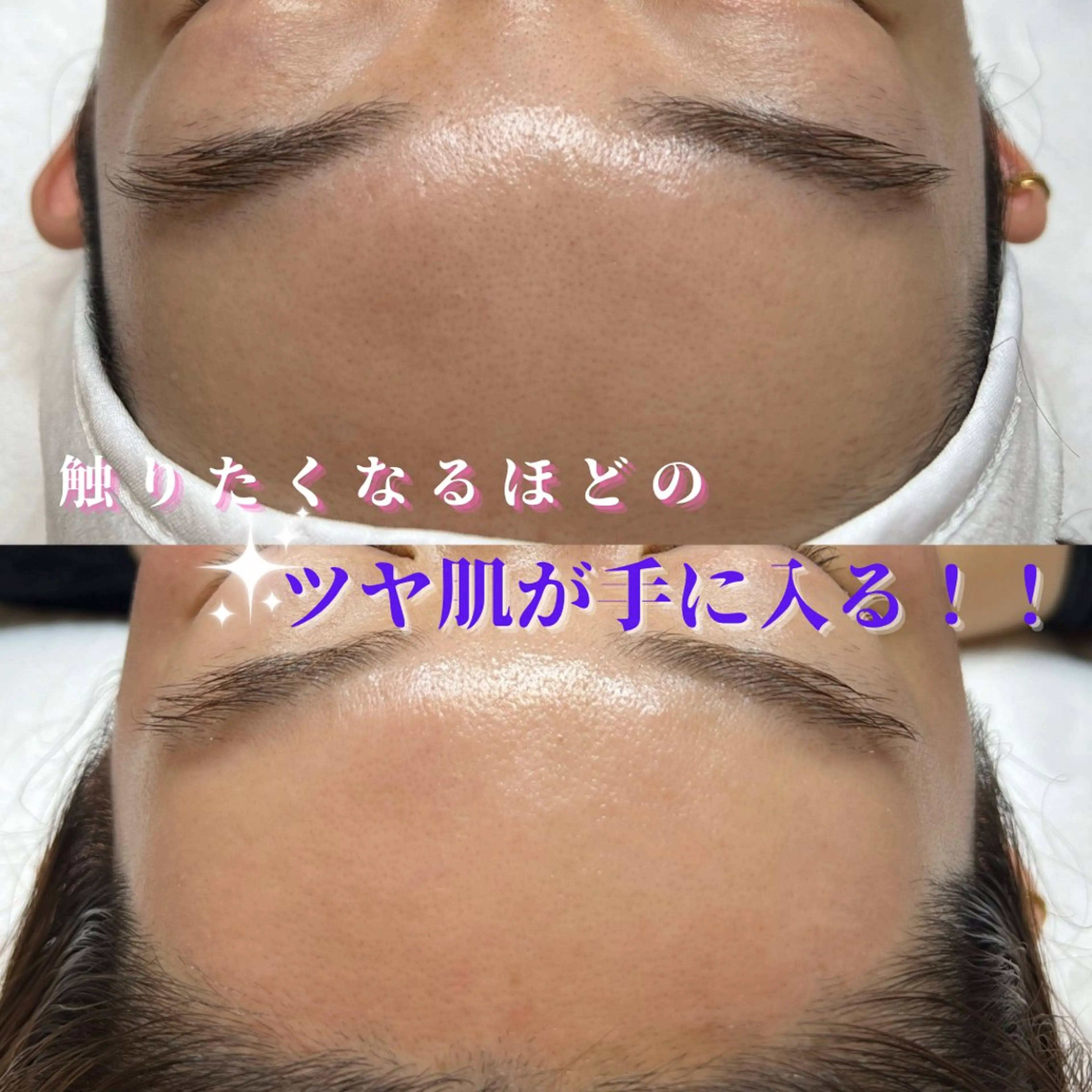 脱毛 brilliant .のエステ・リラクイメージ