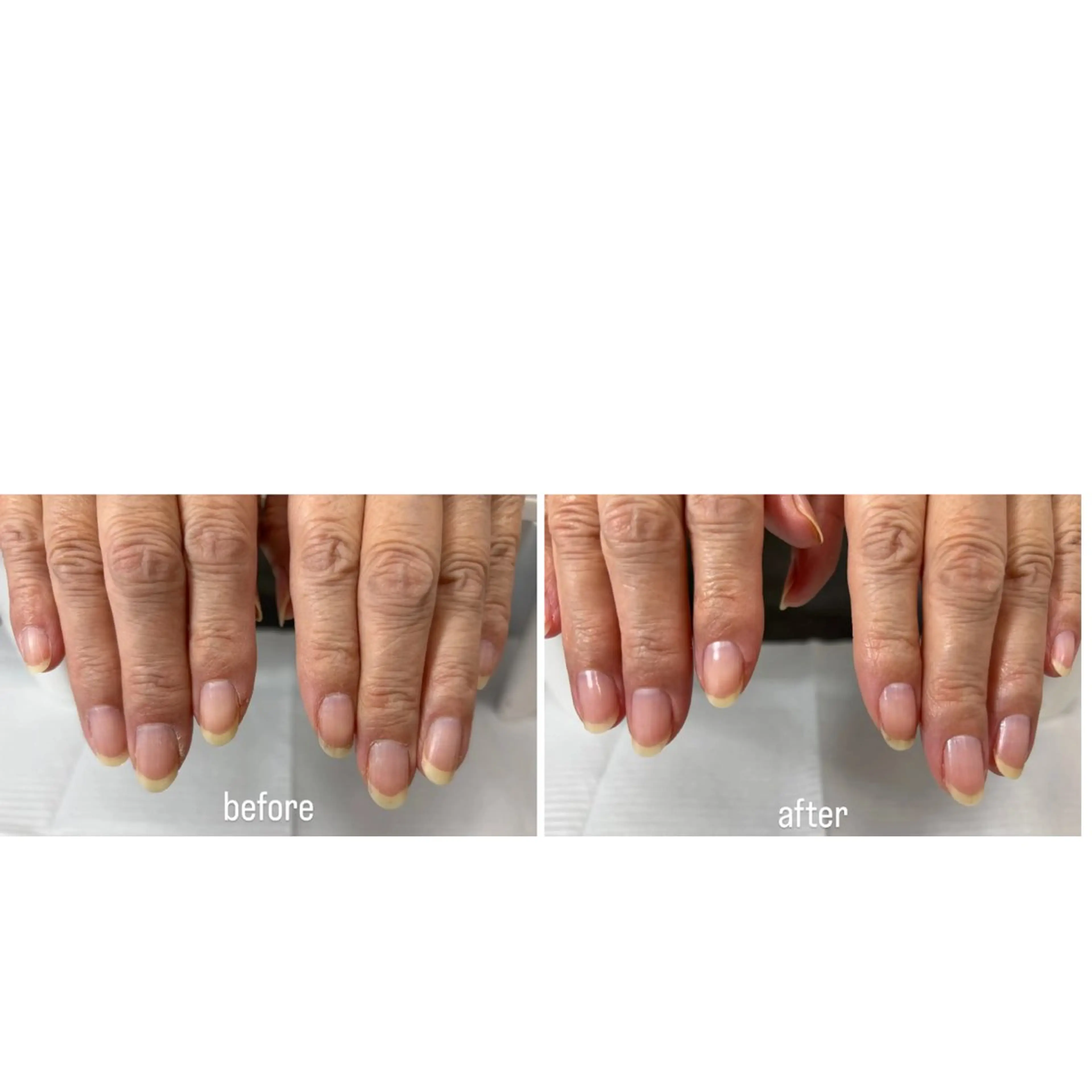 ハンドケアの写真