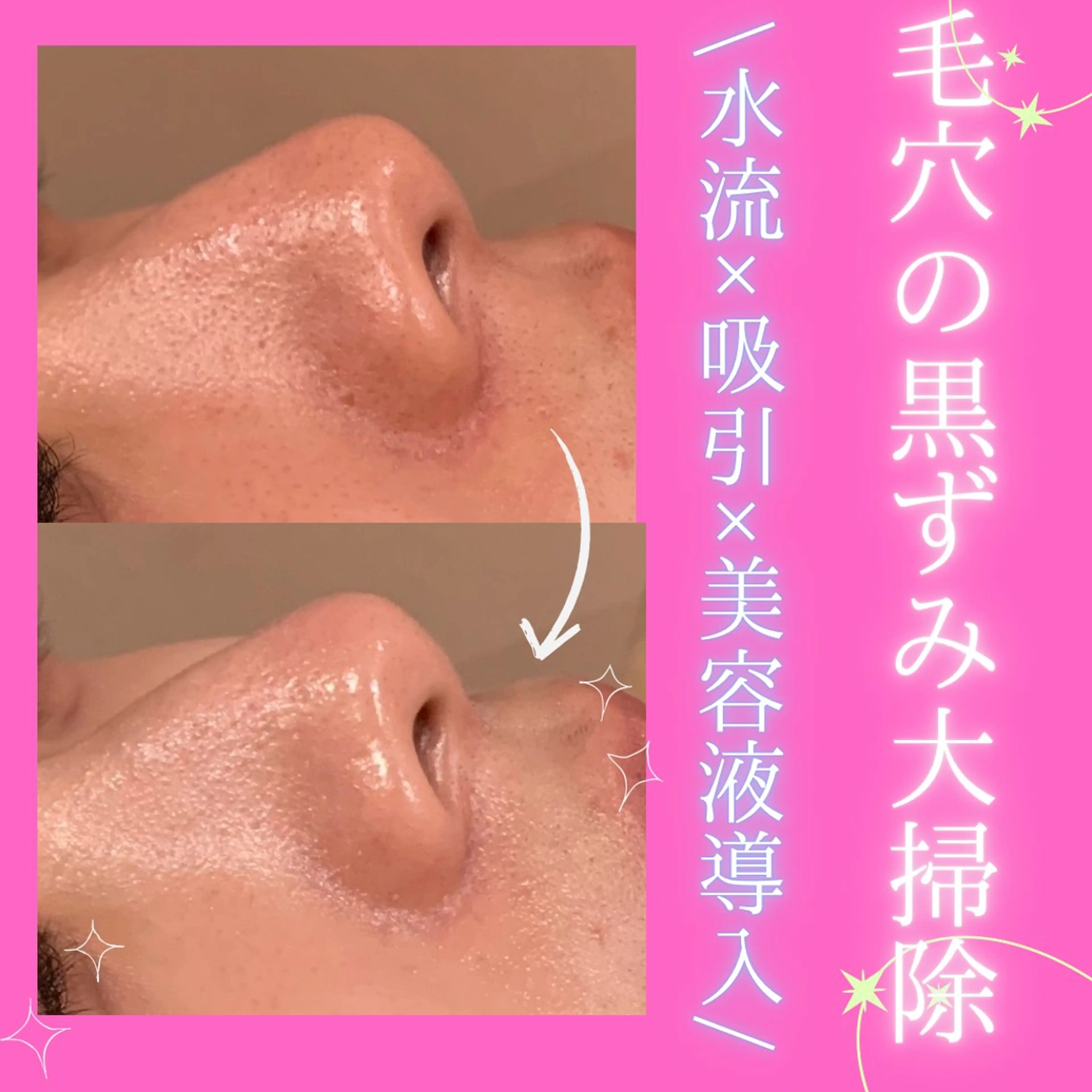 エステ リラク 痩身&美肌サロン 堀米✨のその他イメージ