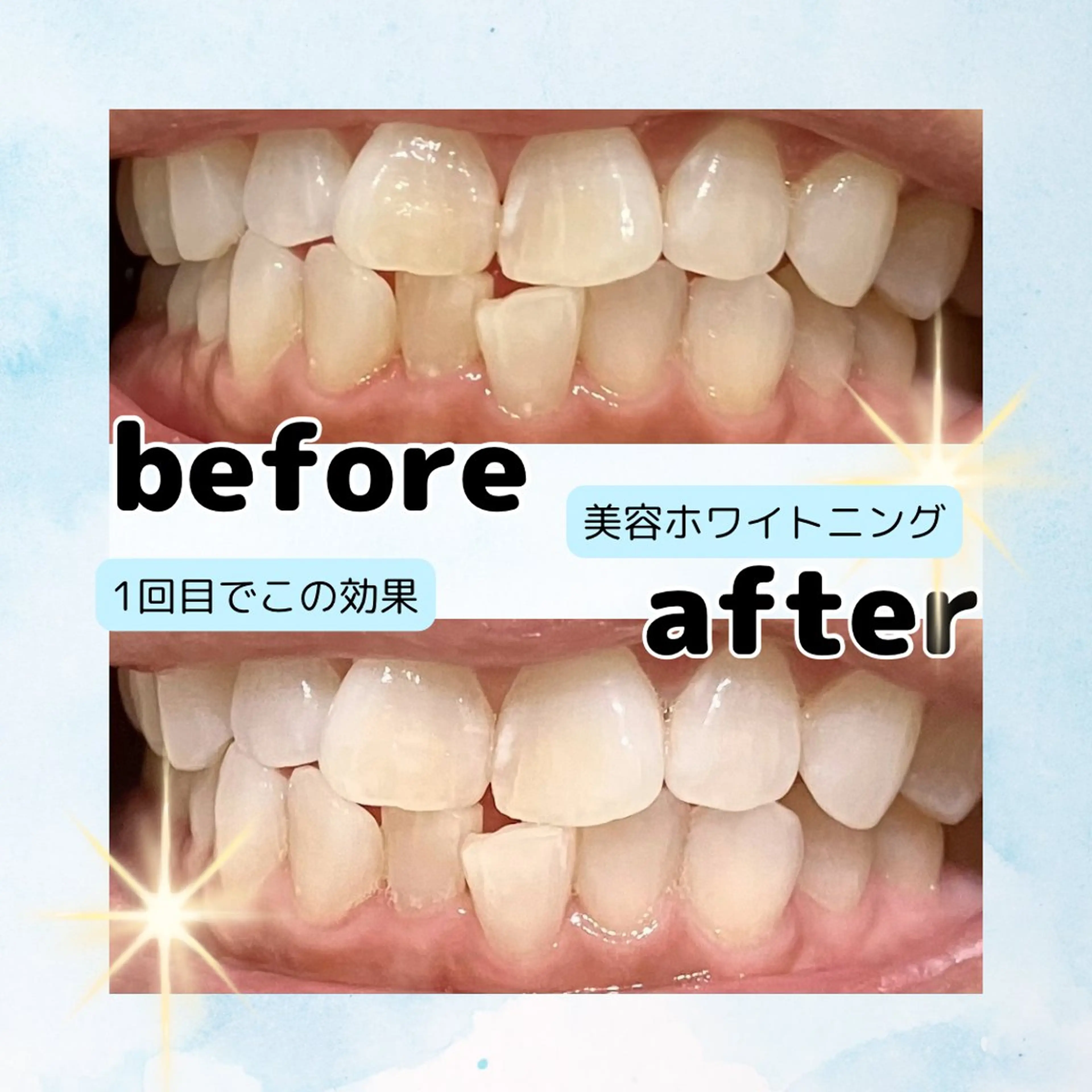 ホワイトニングサロン Soleilのその他イメージ