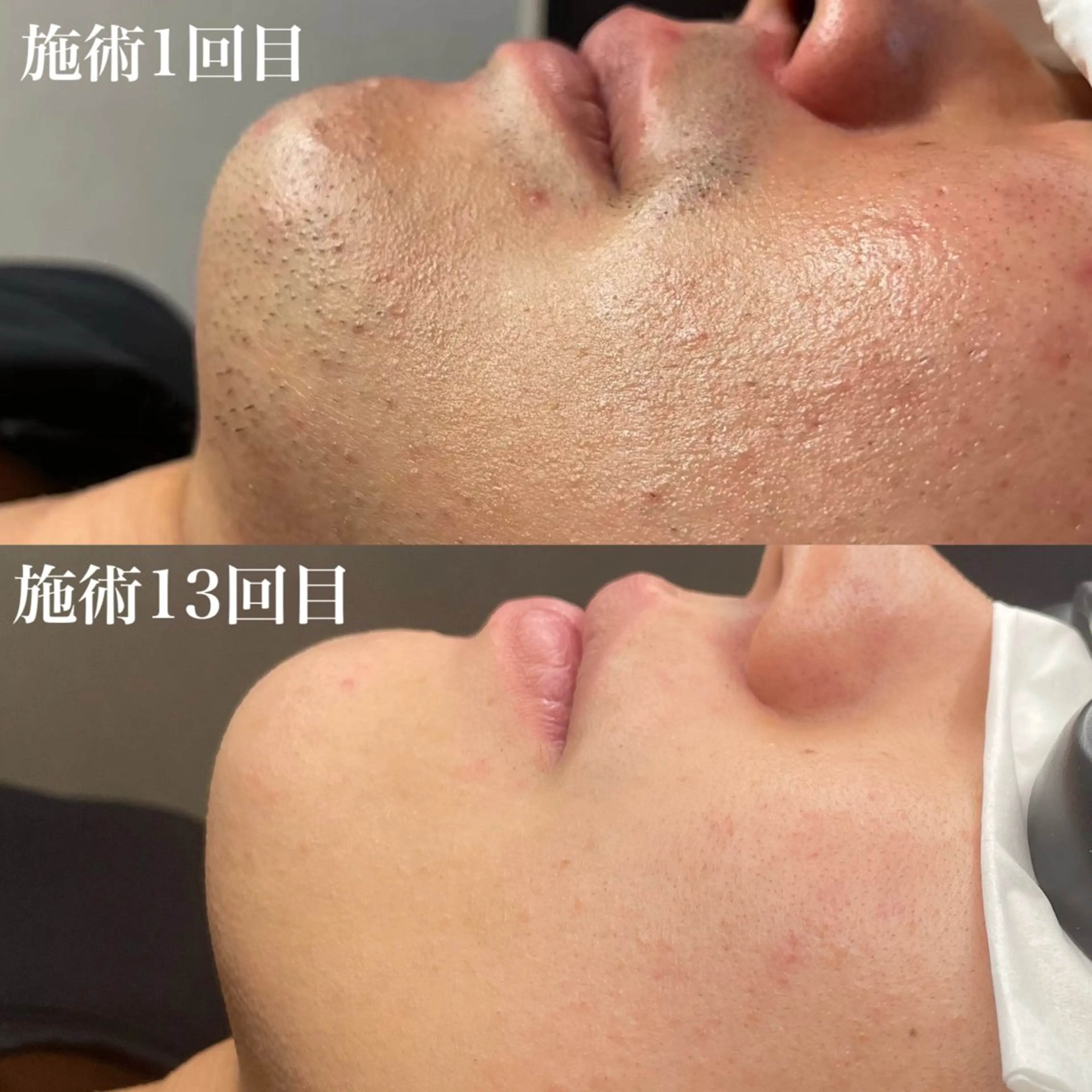 メンズ Esthetic Salon ECLIA所属・ECLIA 中田のエステ・リラクイメージ