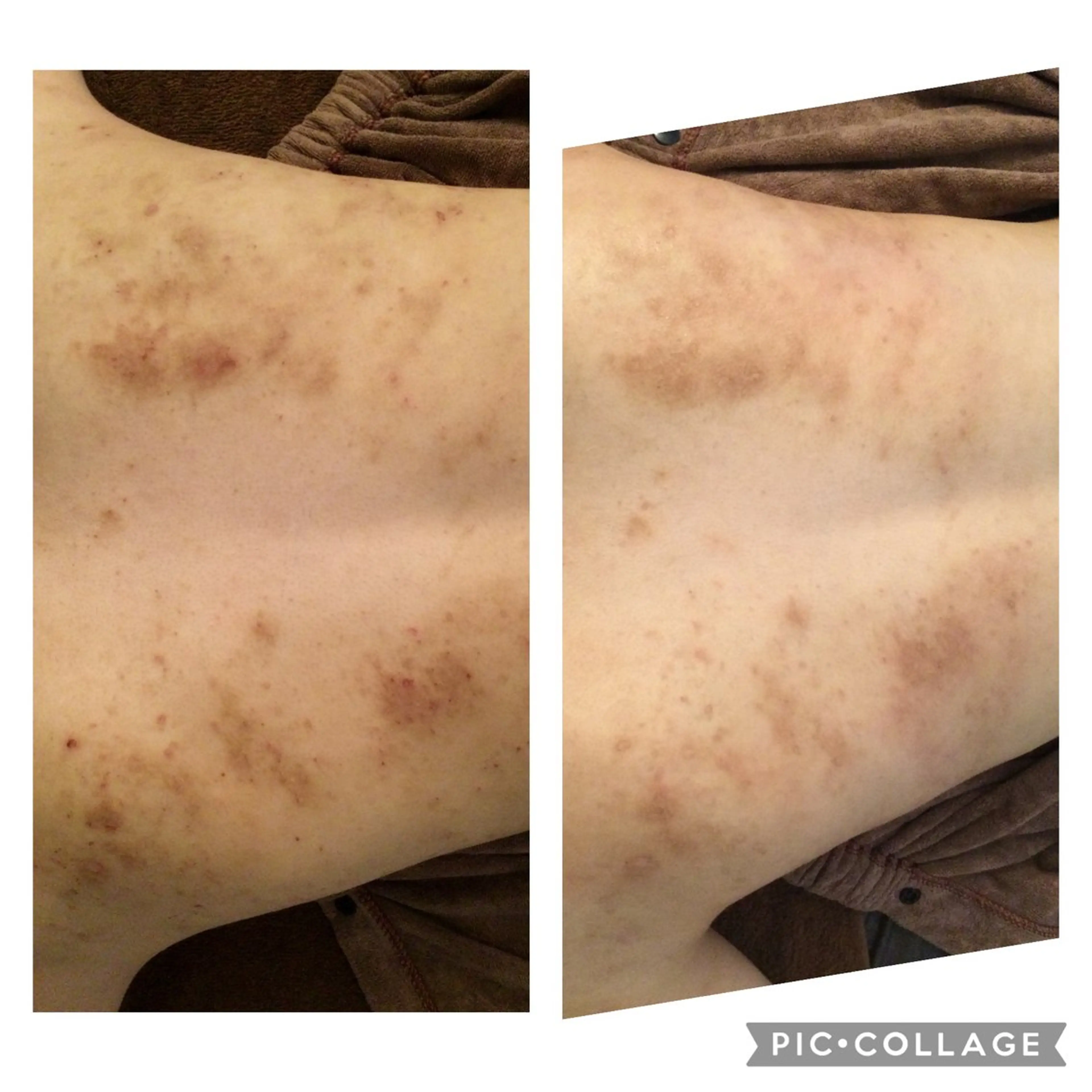 エステ リラク ニキビ/肌質改善専門 Snow skinのエステ・リラクイメージ