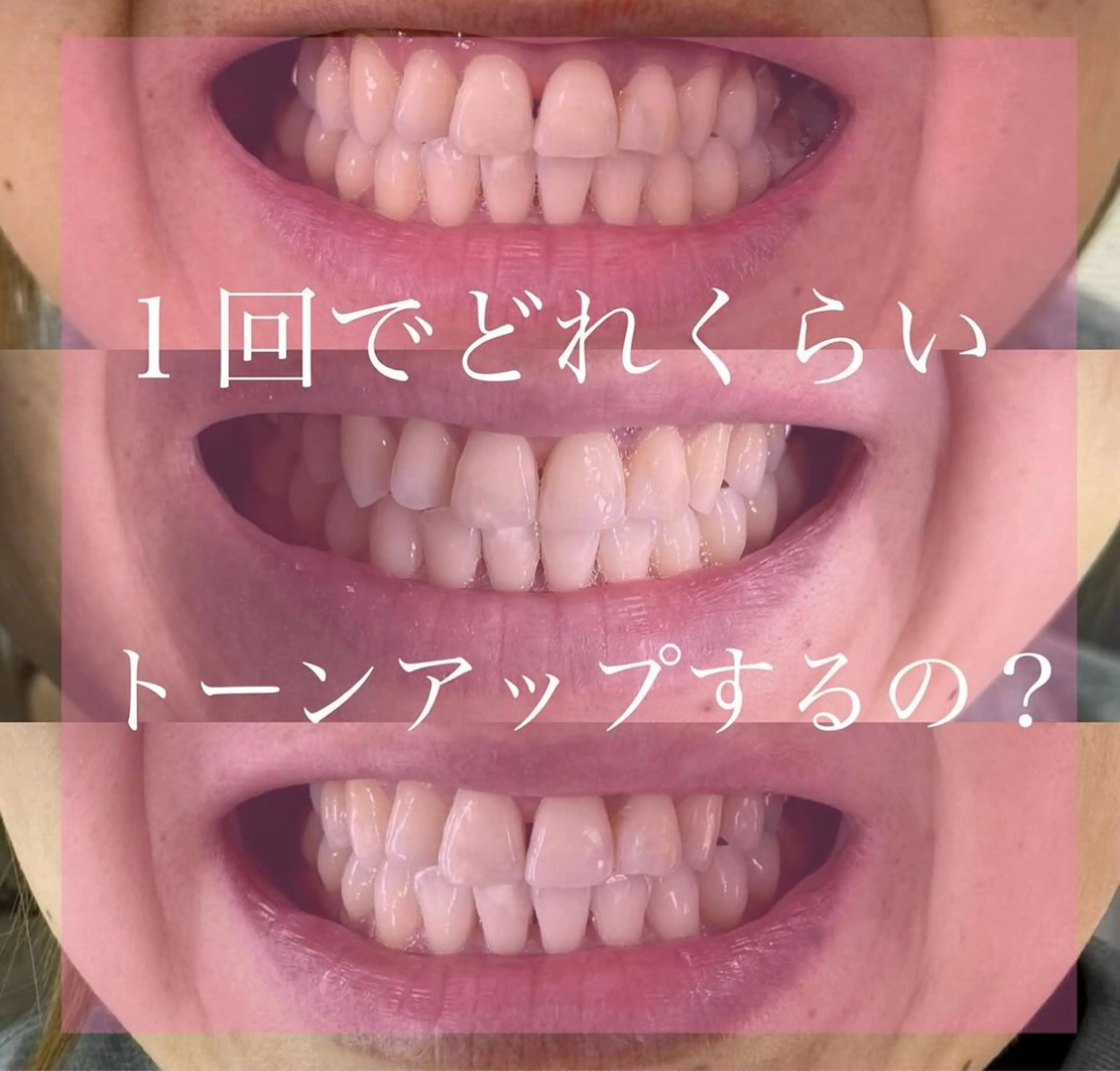 Livicate 💗🧁🎀🦋のマツエク・マツパデザイン