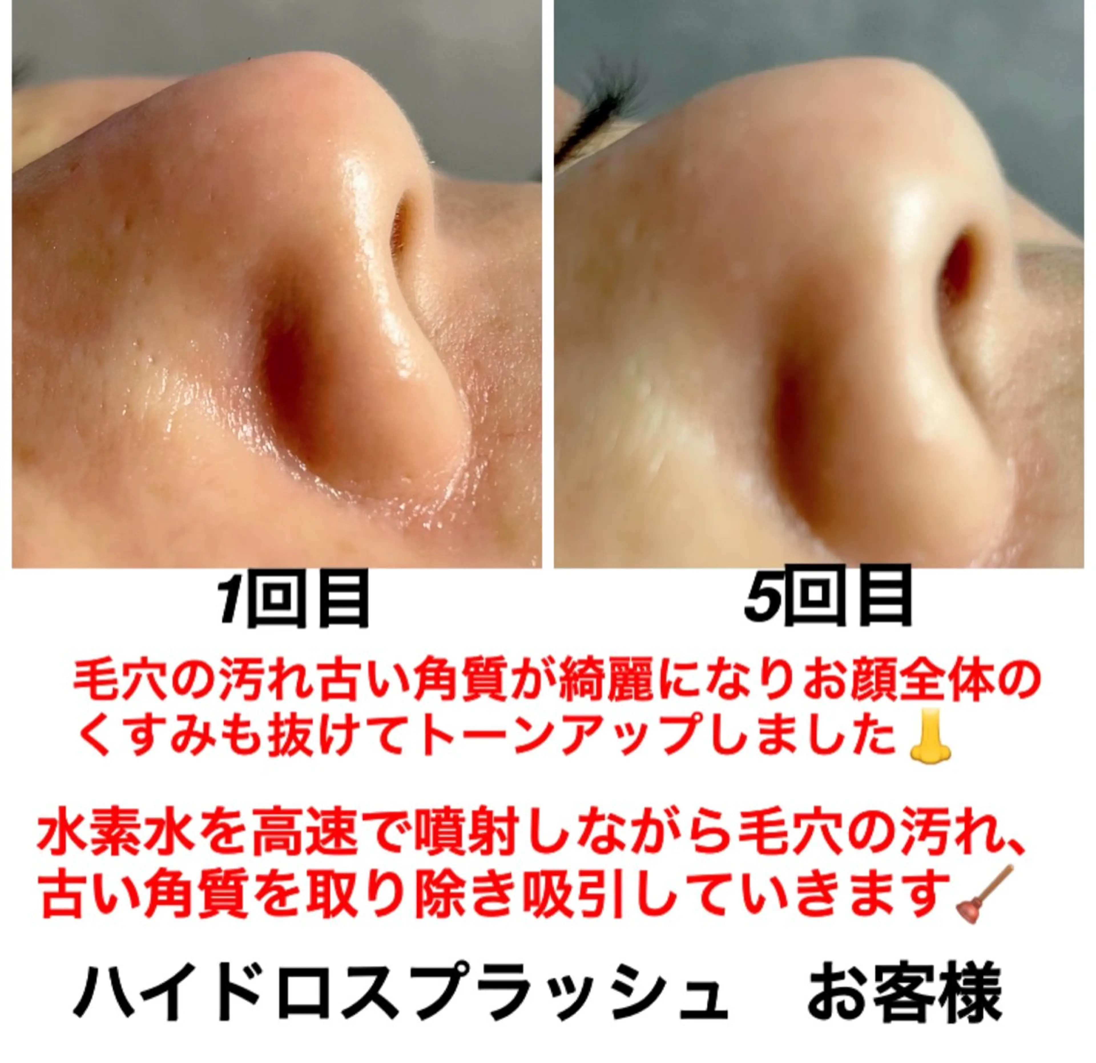 エステ リラク ネイル・エステサロンUILANI所属・ネイル・エステサロン UILANIのネイルデザイン