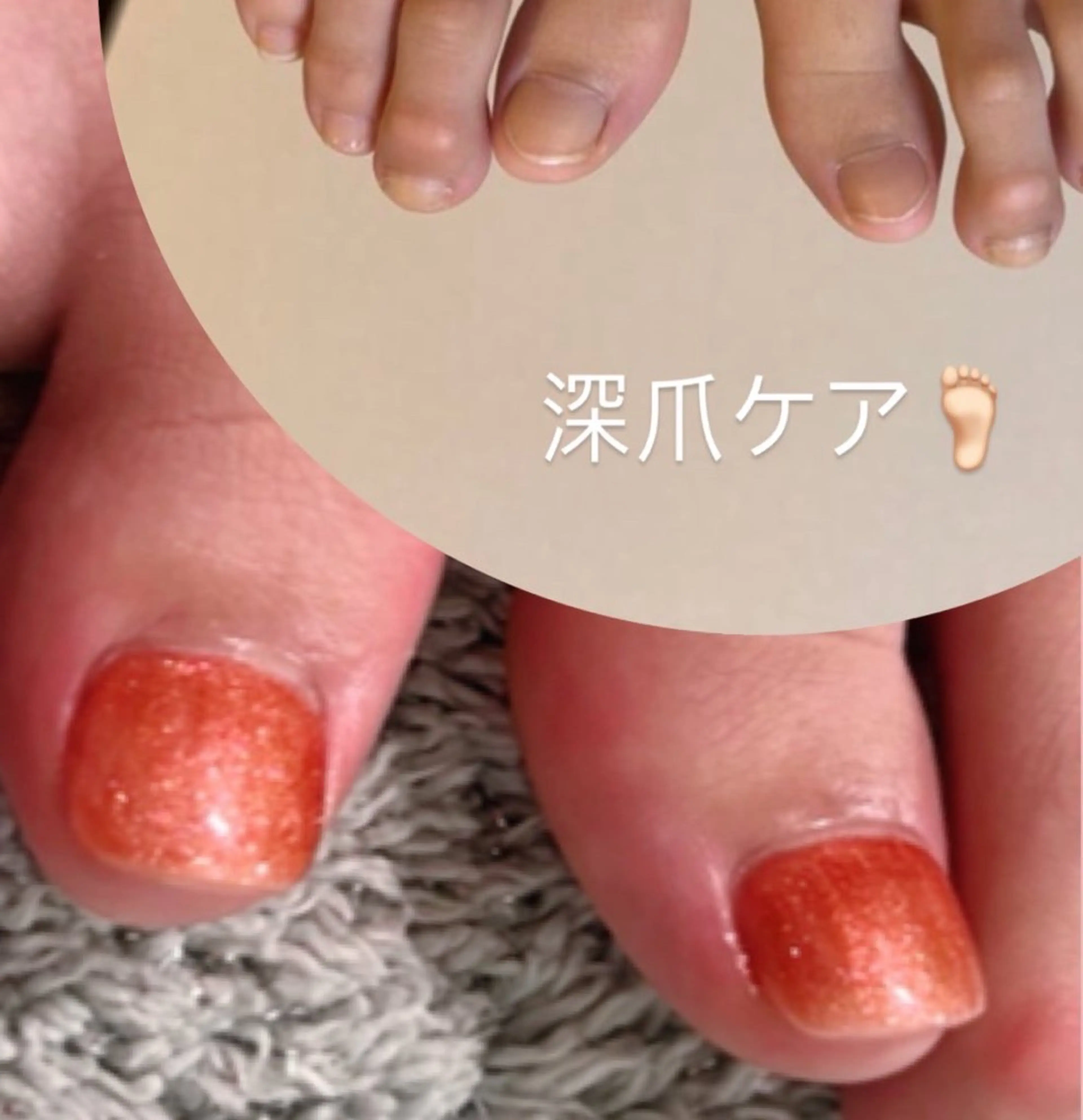 メンズ ネイル 爪ケア/深爪 自爪育成 🐰えむのネイルデザイン