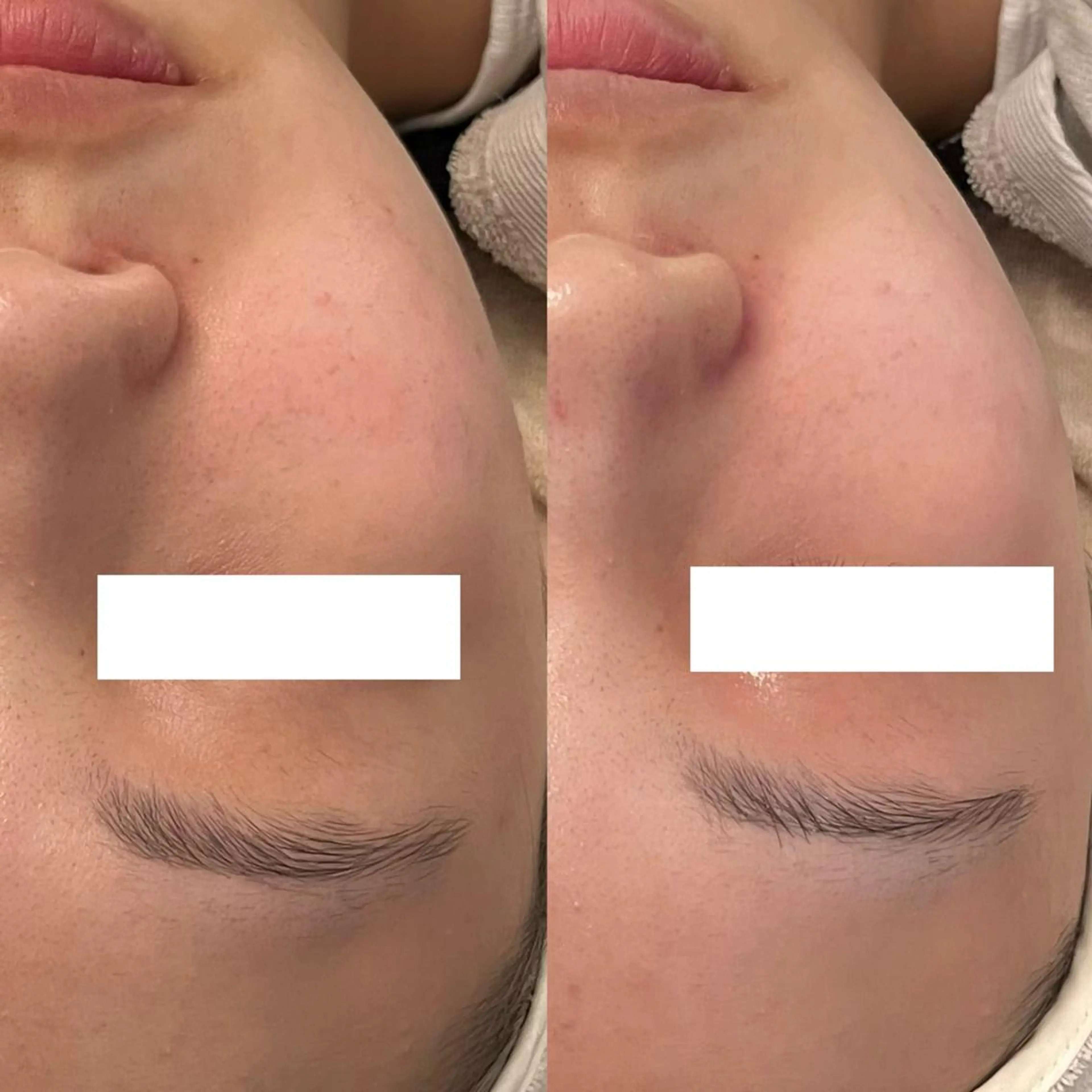 エステ ララ/ハーブ メゾンリュバンのエステ・リラクイメージ