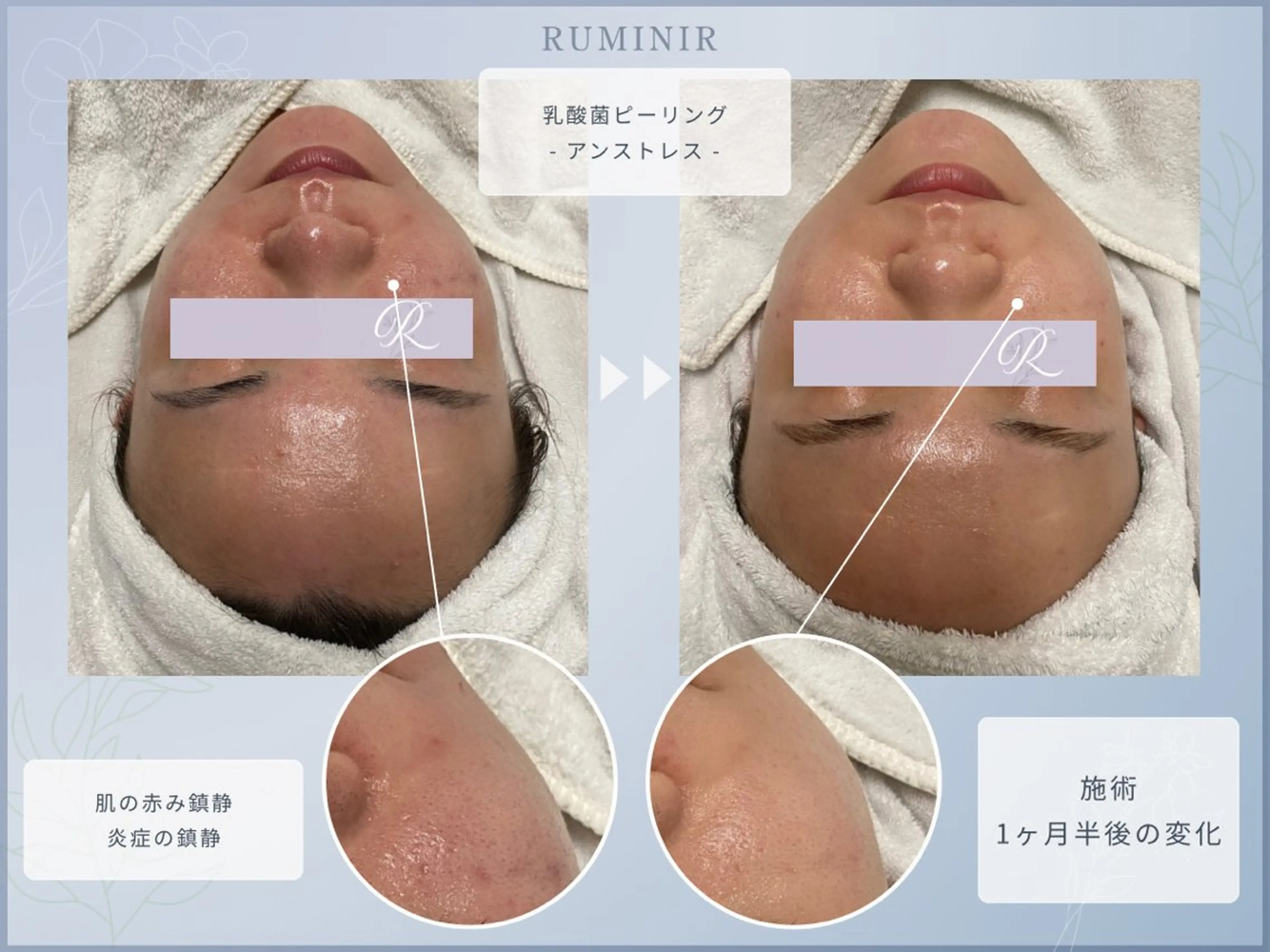 【肌質ケアサロン】 RUMINIRのエステ・リラクイメージ