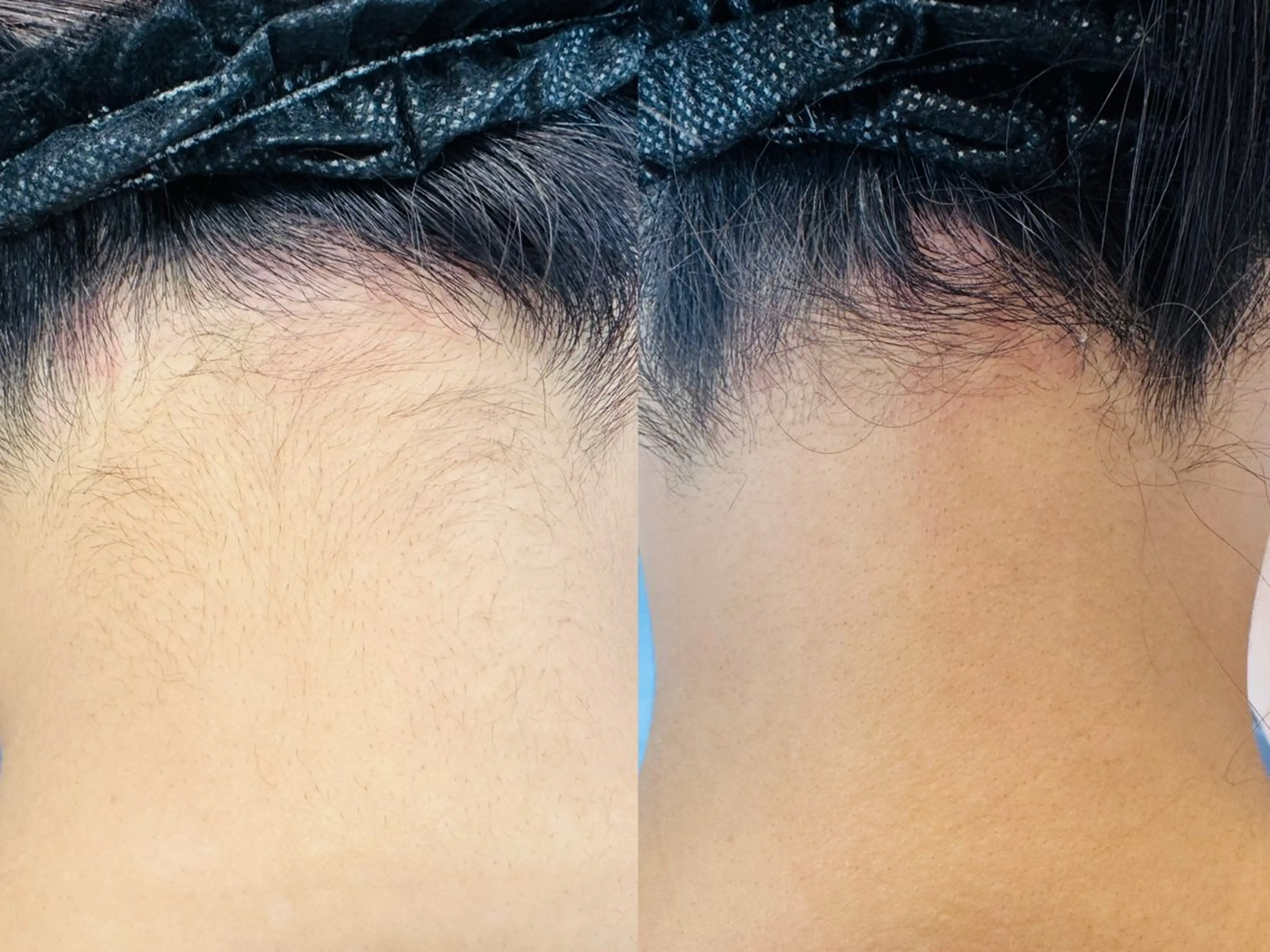 LukeBeauty salonのエステ・リラクイメージ