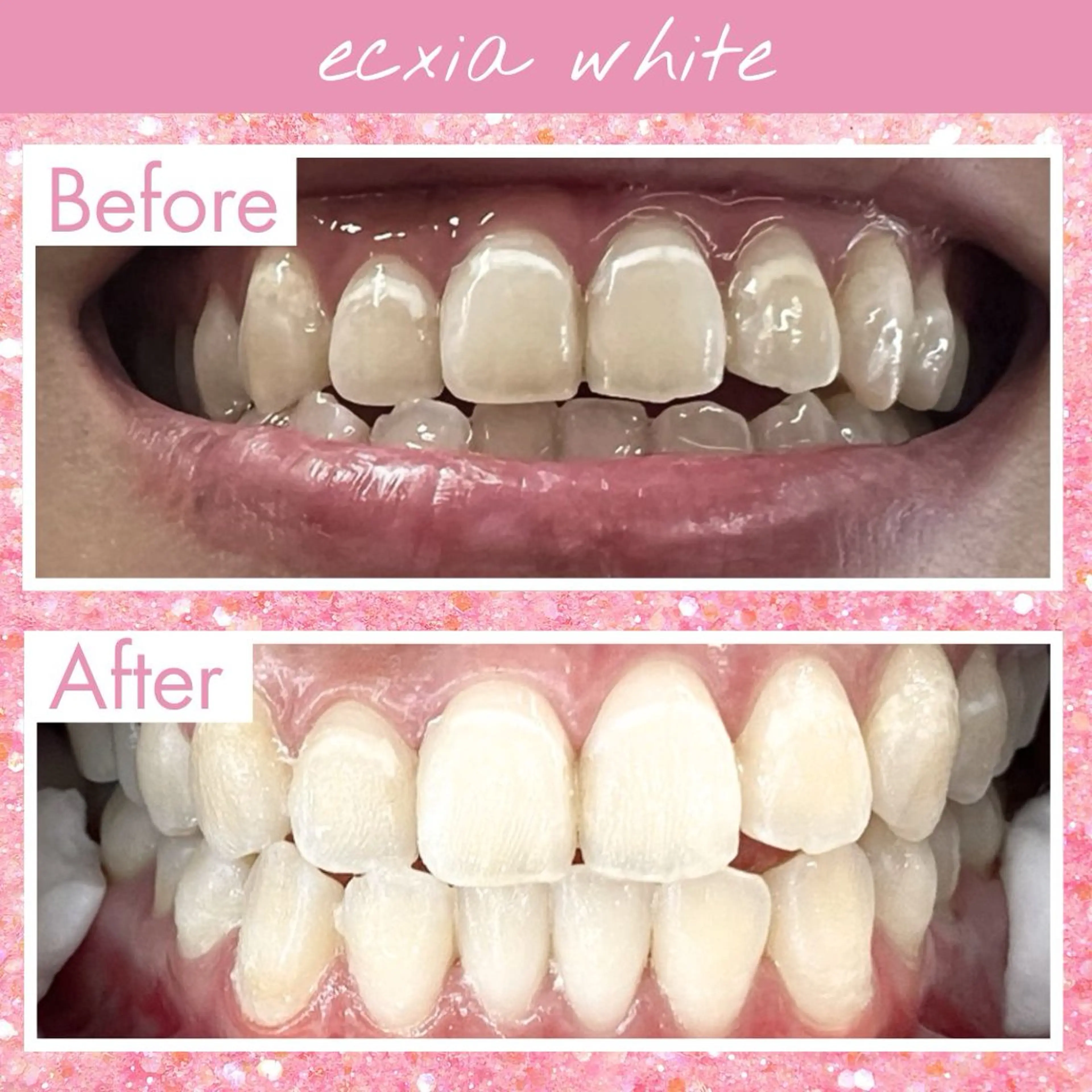 その他 エクシアホワイト福岡六本松所属・喜多 美佳のその他イメージ