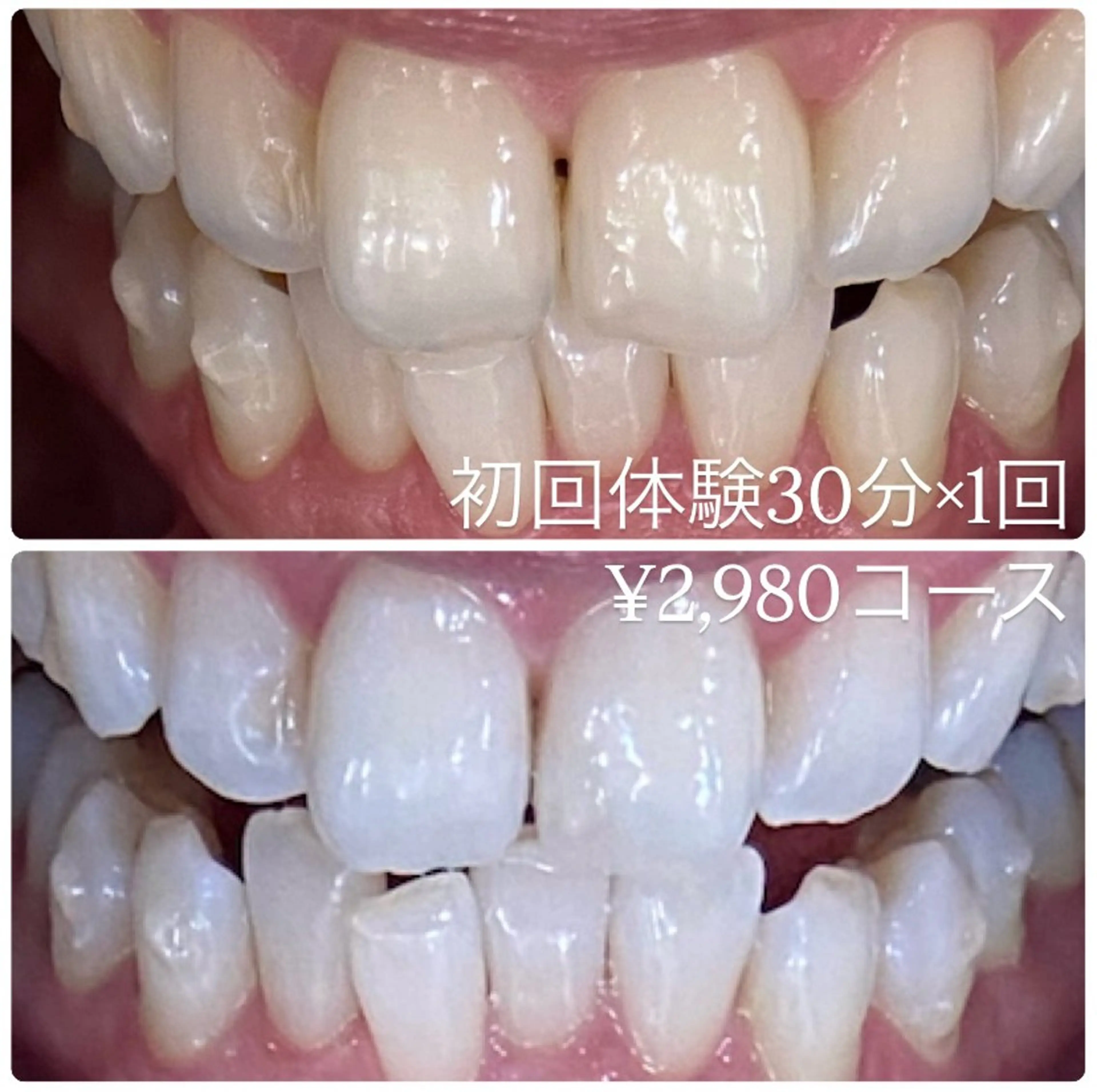 ホワイトニングルーム 横浜店のその他イメージ