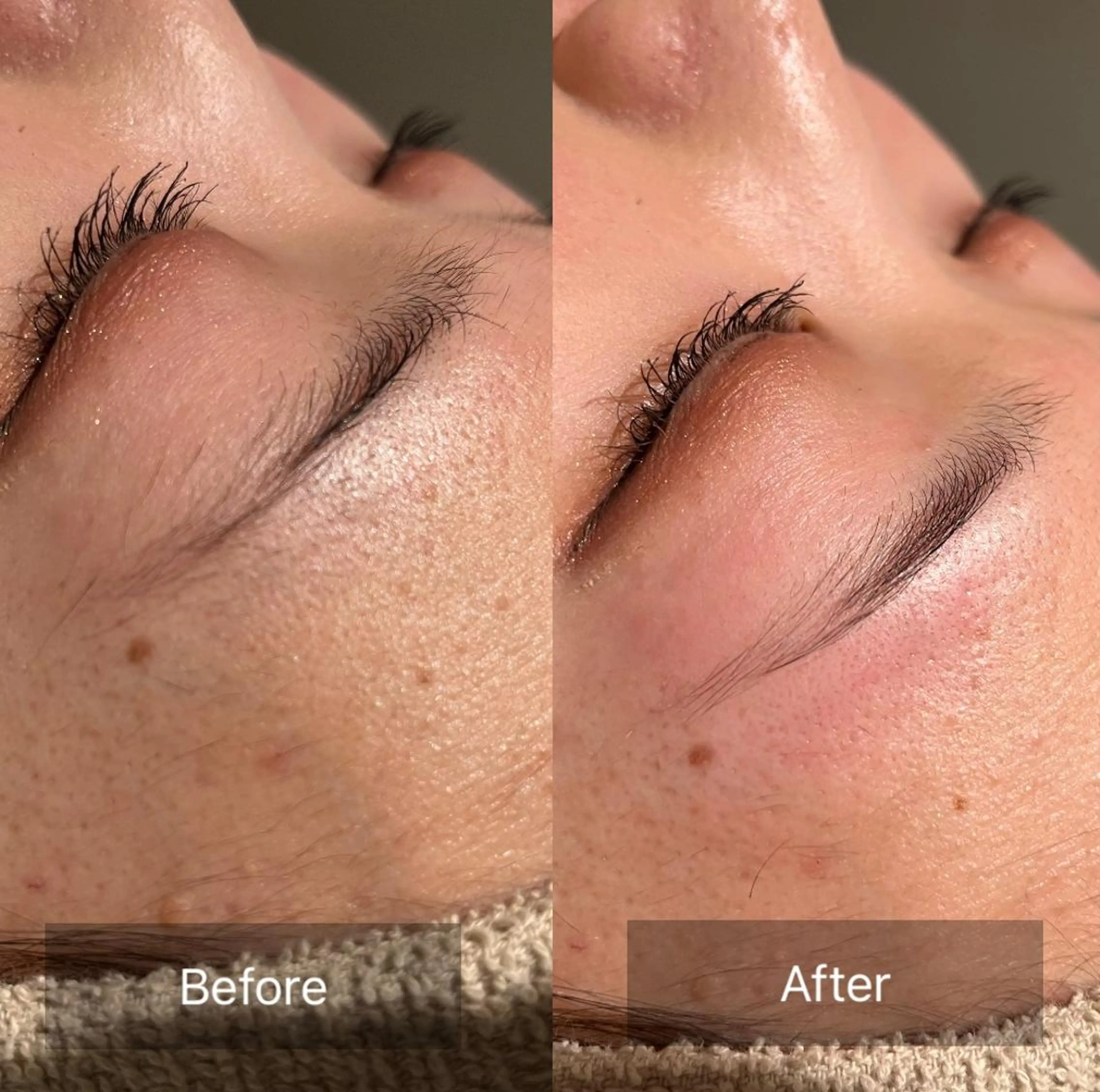 アイブロウ for woman所属・森 美優のエステ・リラクイメージ