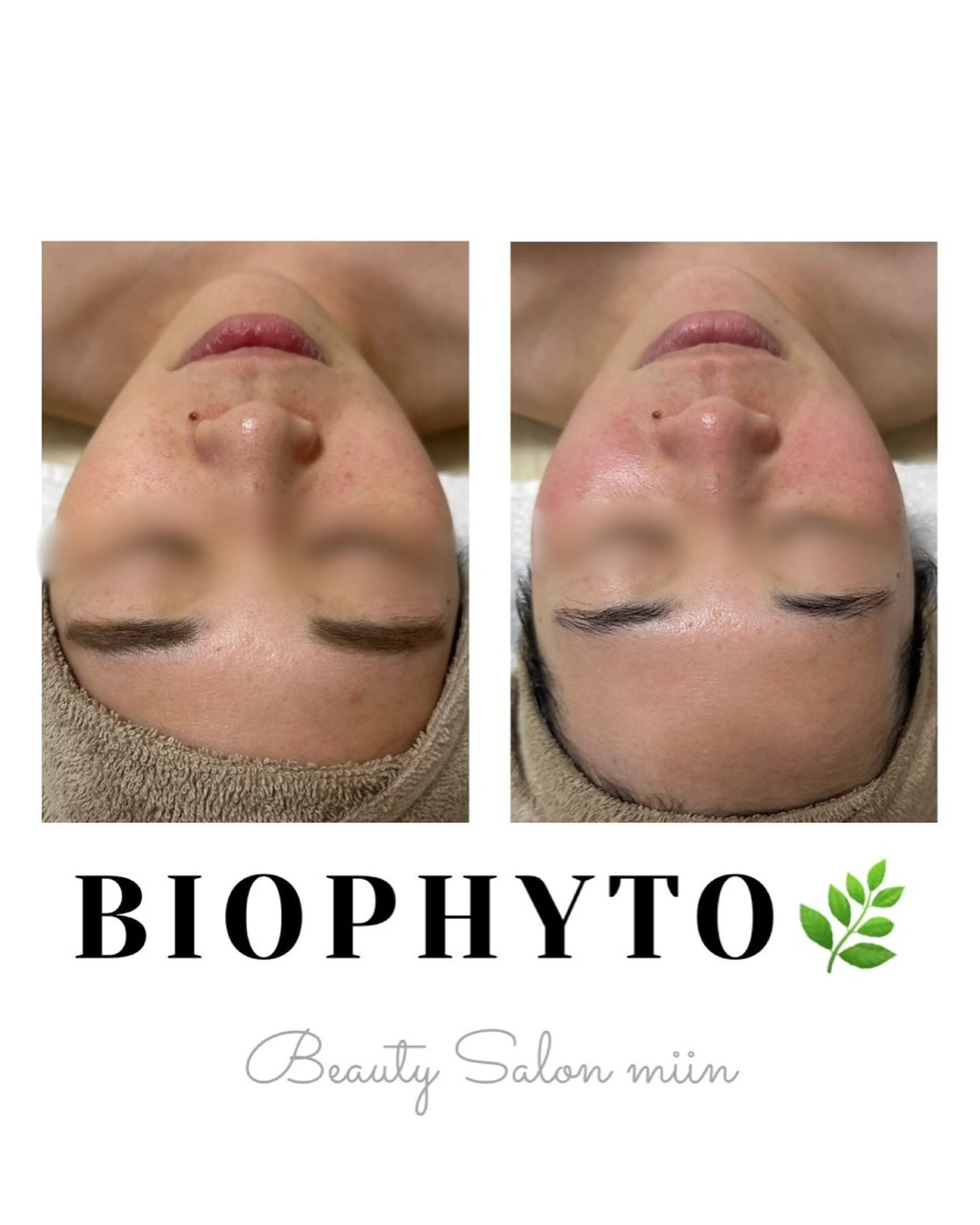 エステ 韓国肌管理 白玉肌管理®︎のエステ・リラクイメージ