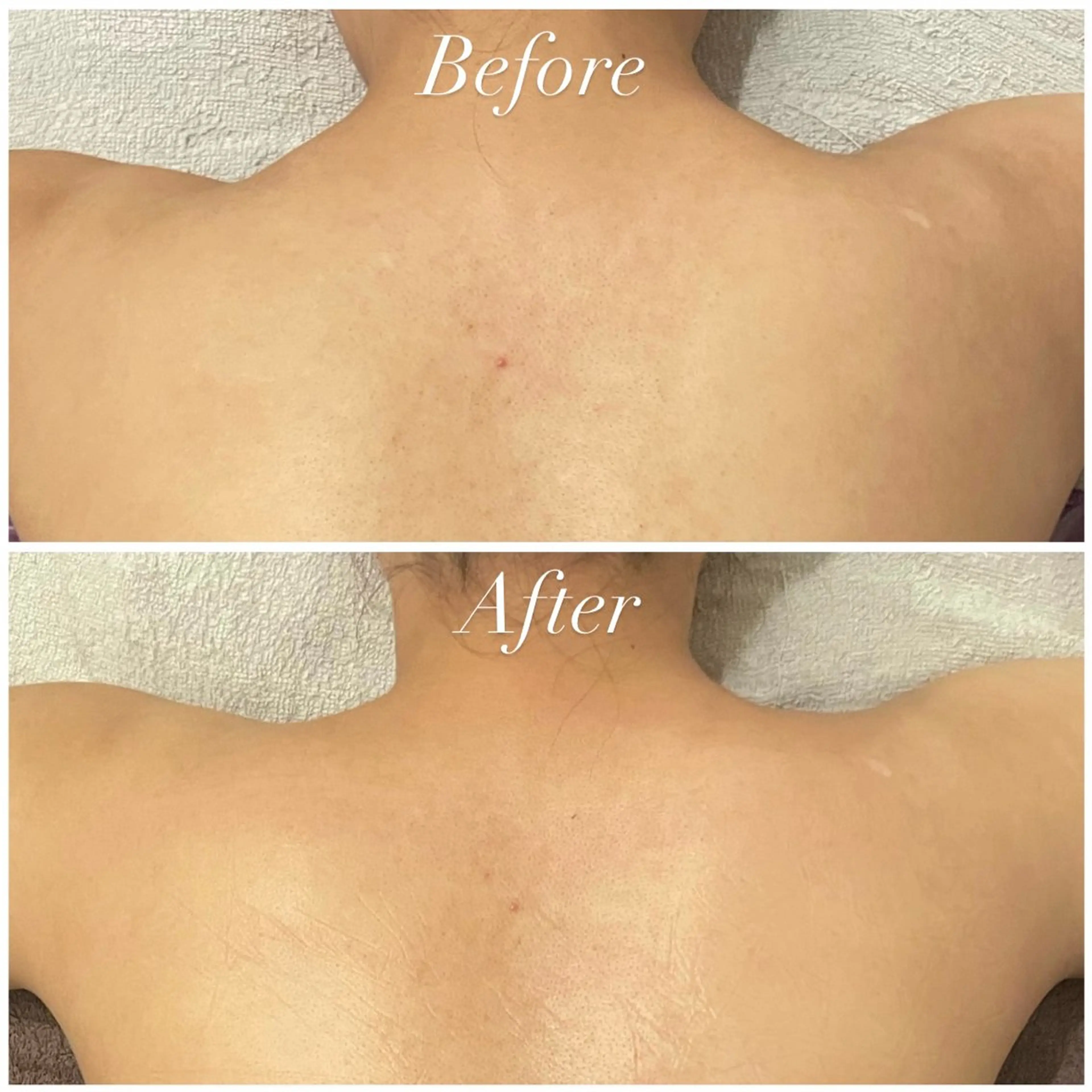 エステ リラク Tulipe Chihoのエステ・リラクイメージ