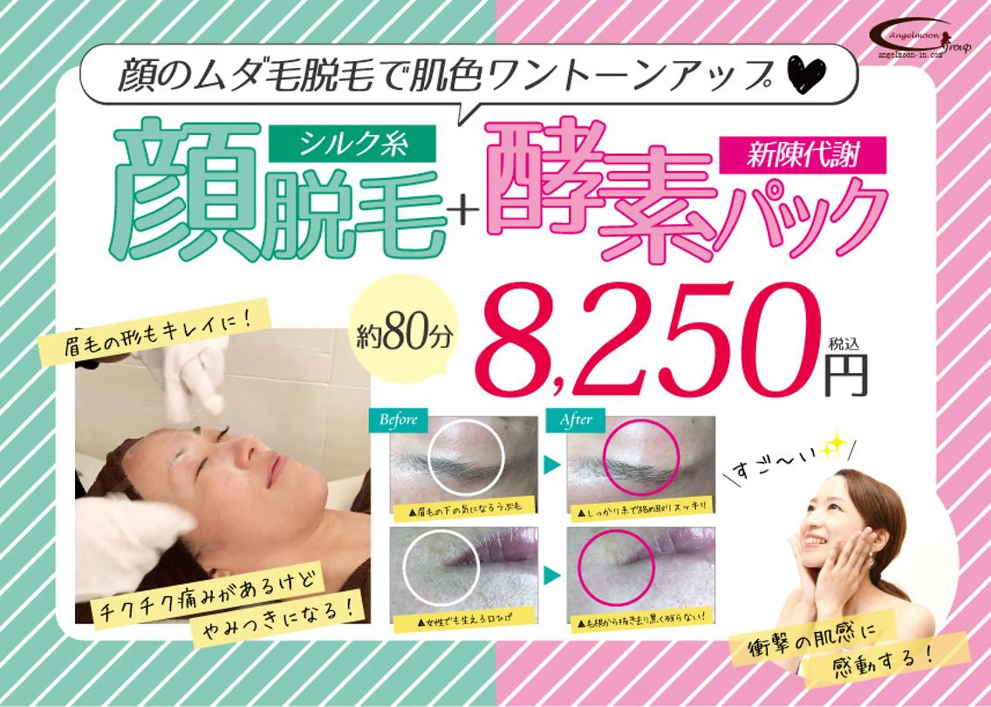 【ご新規様限定】顔脱毛+酵素パック80分¥7750の写真