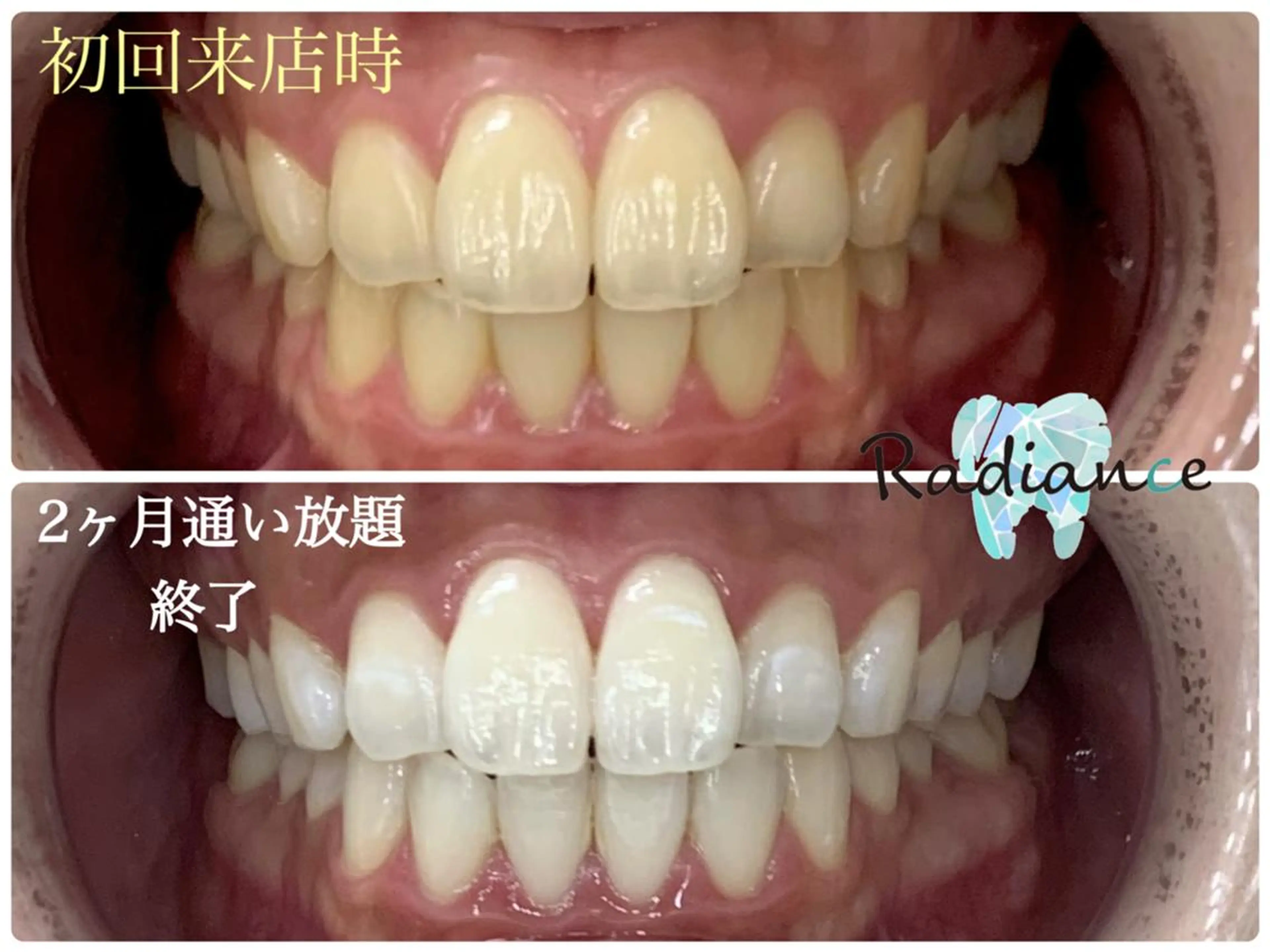 札幌ホワイトニング ラディアンス菊水店のその他イメージ