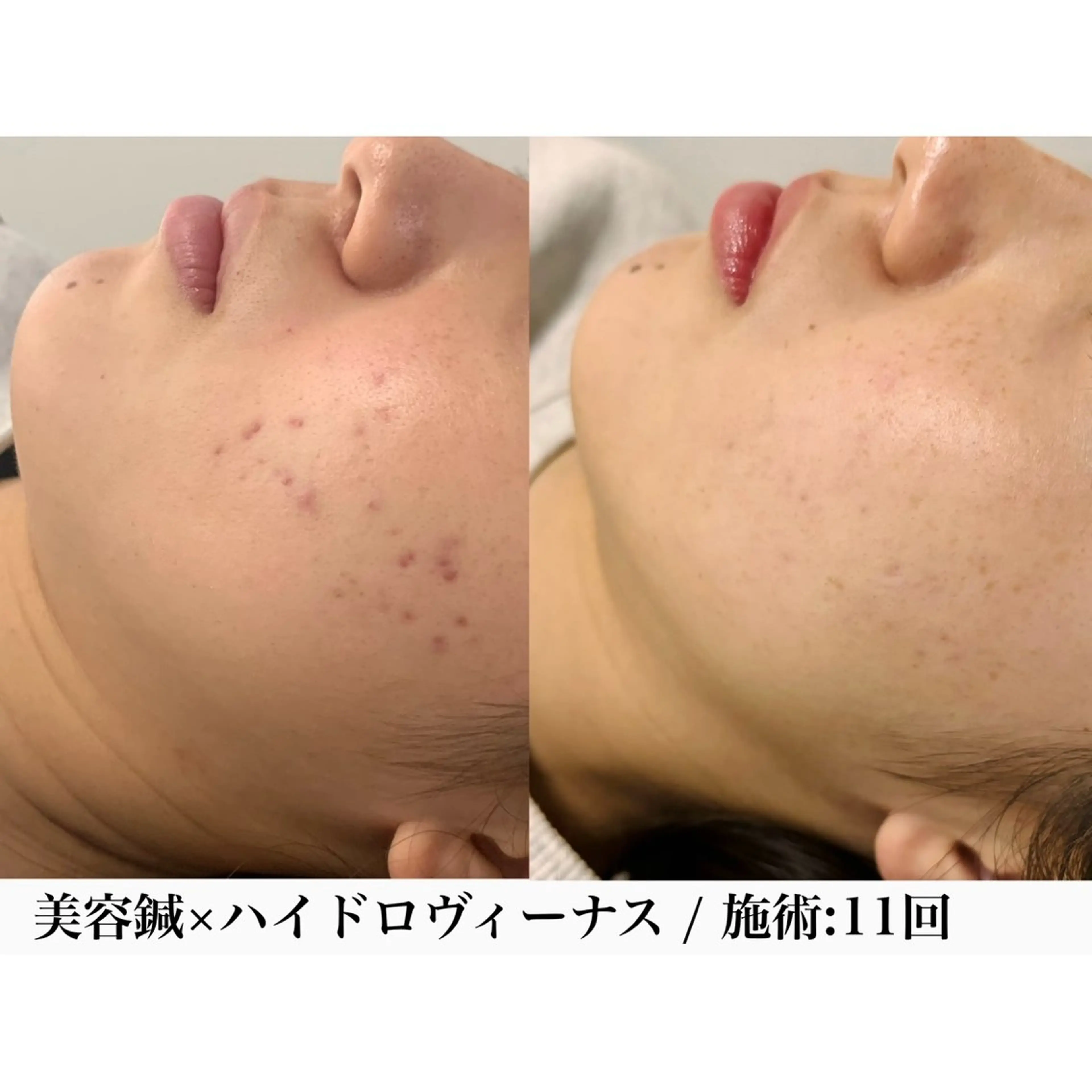 堀之内宏次 ［美容鍼灸師］のエステ・リラクイメージ