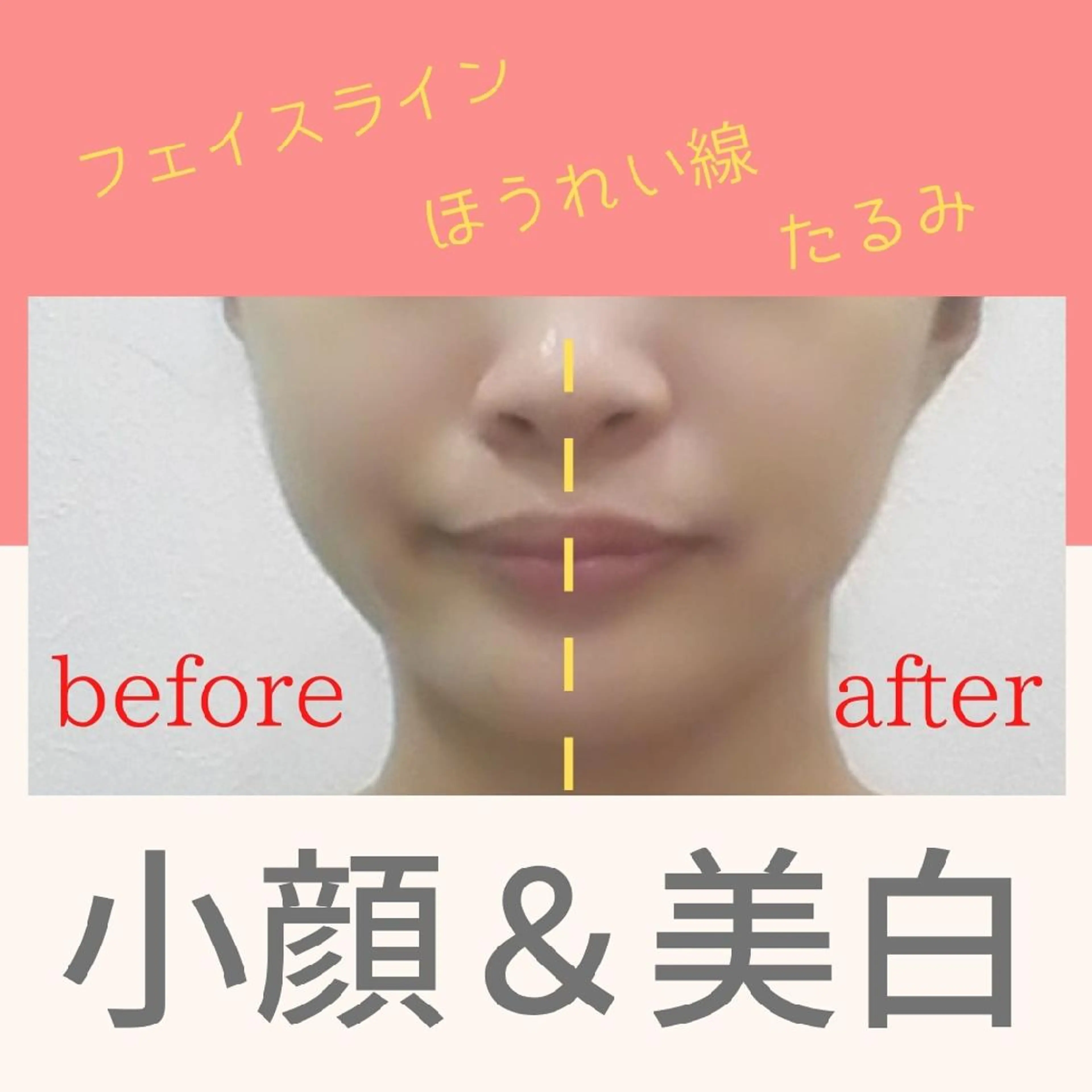 迷ったらこちら！徹底美肌ケア🌼EMSケアで小顔ケア&コラーゲン美肌光ケアでハリ弾力アップ✨初回14080円→7800円の写真