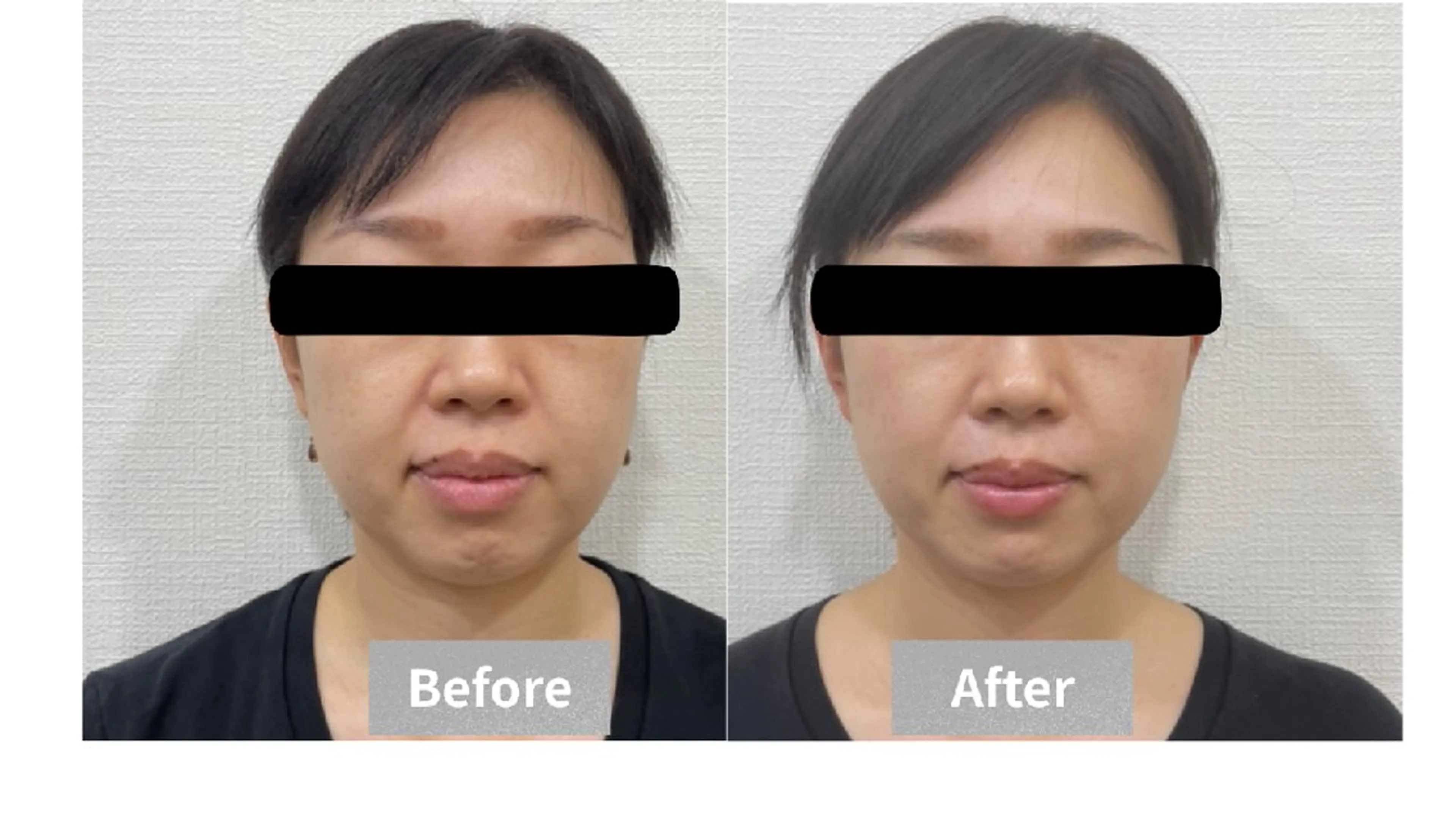 【小顔/むくみ/左右差】フェイスライン集中ケア60分 ¥2,980の写真