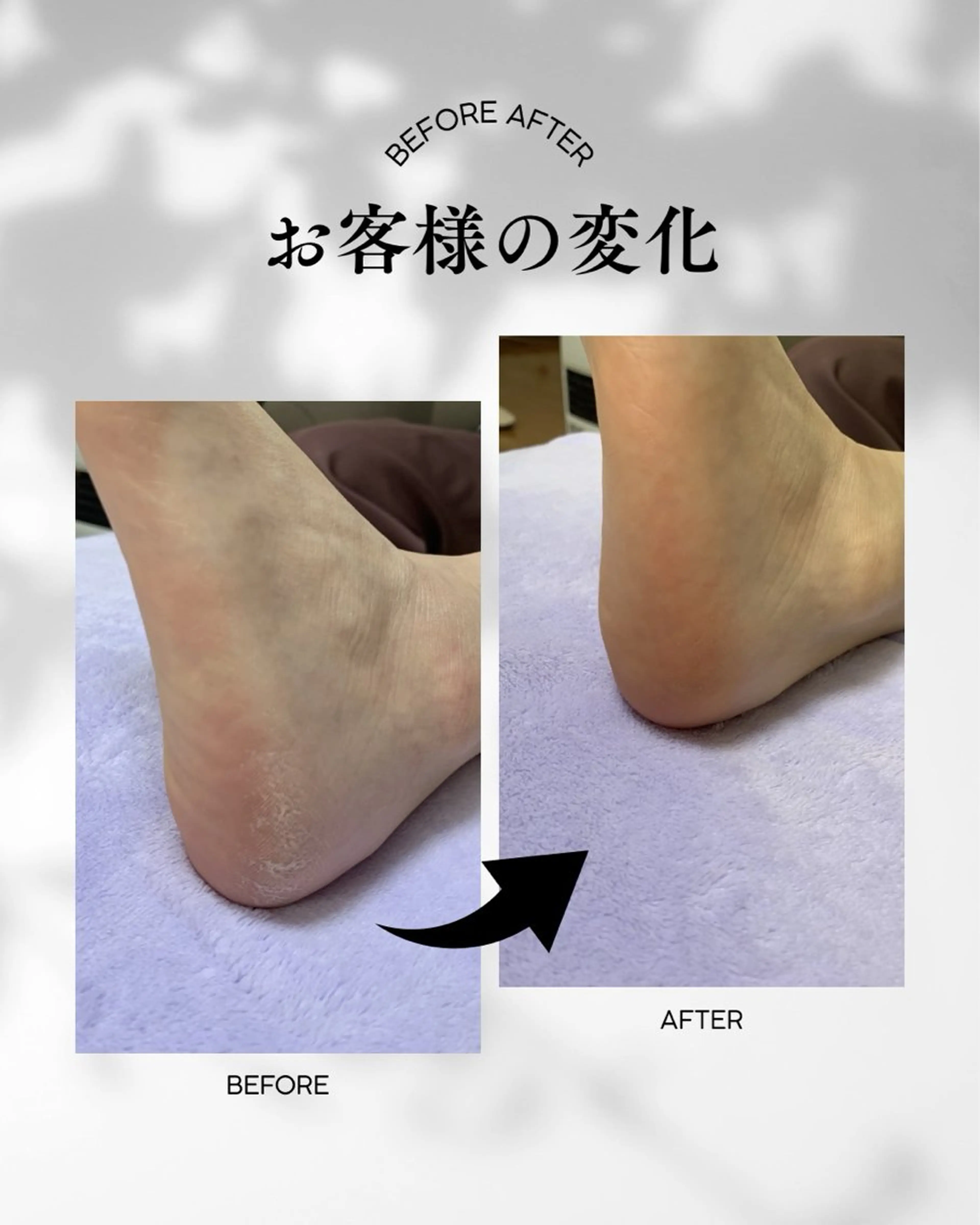 足トラブル専門 ニコルル金沢のエステ・リラクイメージ