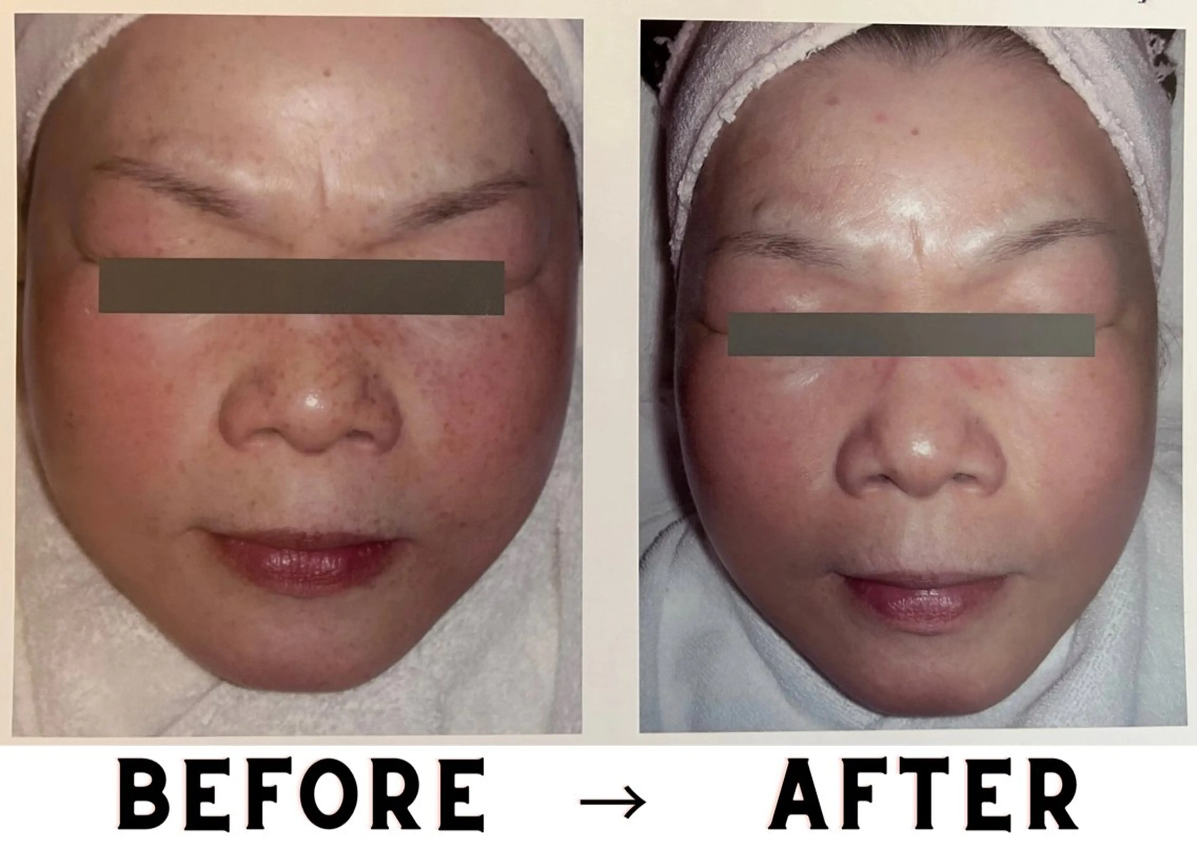 VICTOIRE HAKODATEのエステ・リラクイメージ