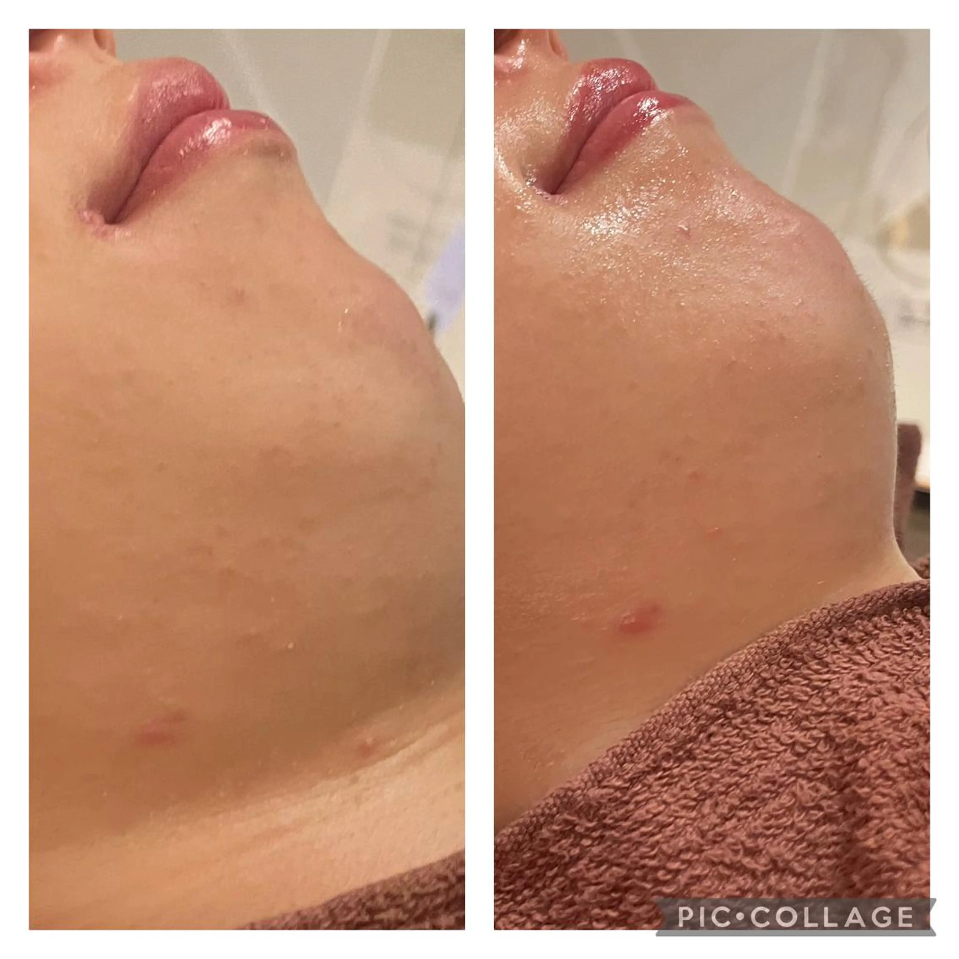 ミディアム カラー パーマ ヘアアレンジ メンズ キッズ ネイル マツエク・マツパ アイブロウ エステ リラク ニキビ特化型エステ 🍋最短で肌質改善のエステ・リラクイメージ