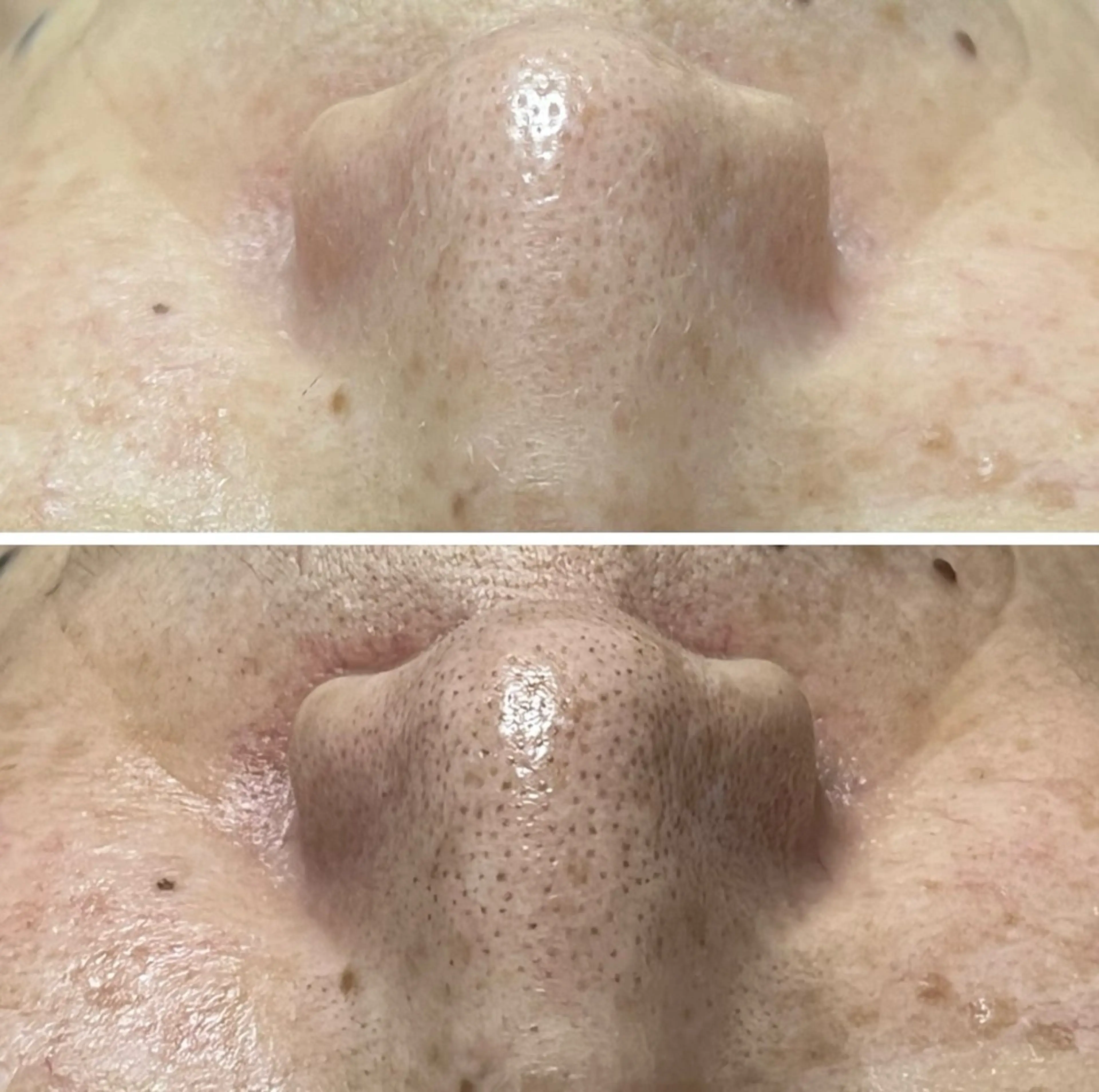 【毛穴の開き、引き締め提案】憧れノーファンデ肌の写真